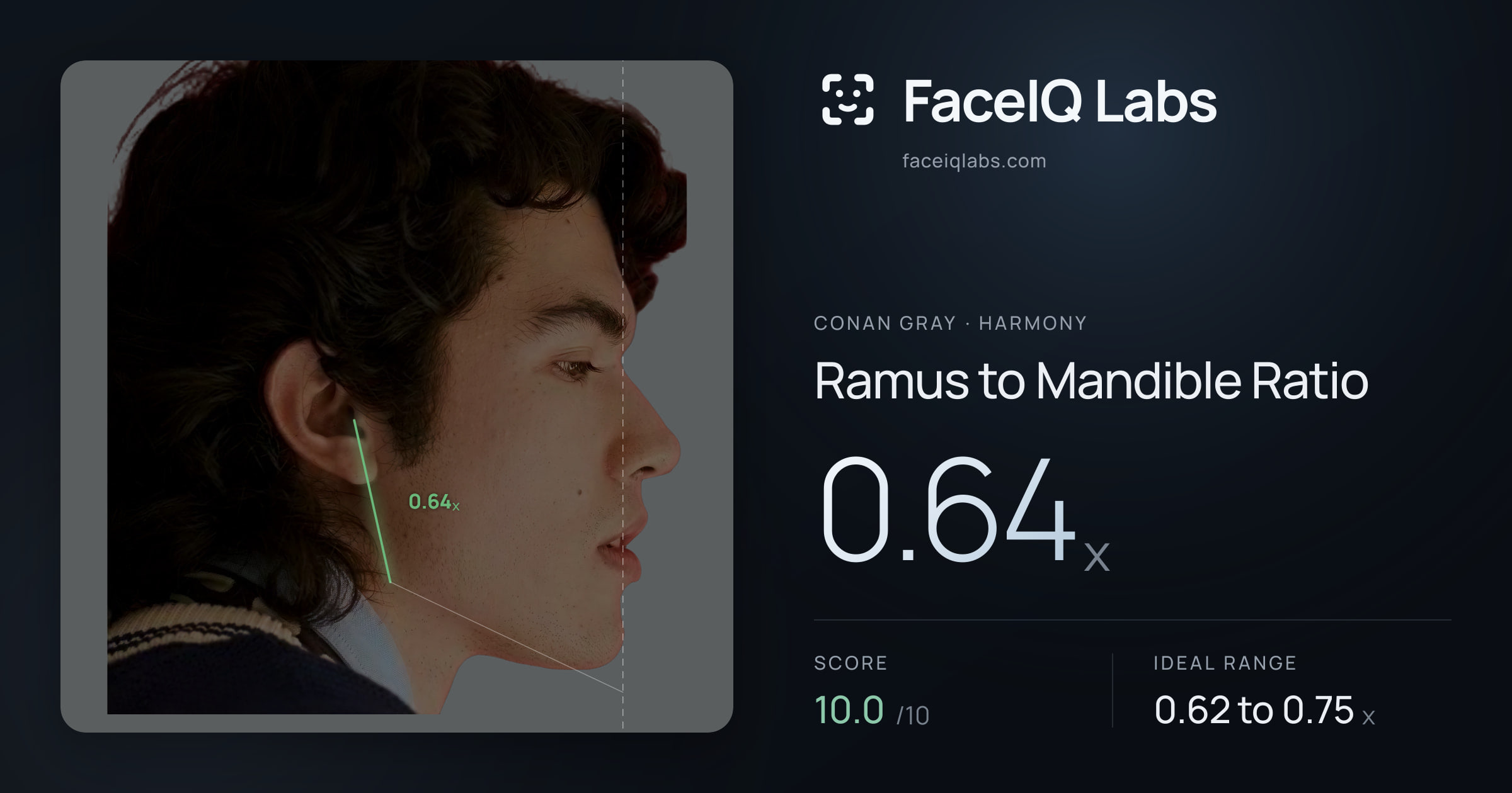 Conan Gray Ramus to Mandible Ratio: 0.64x, drawn on the photo