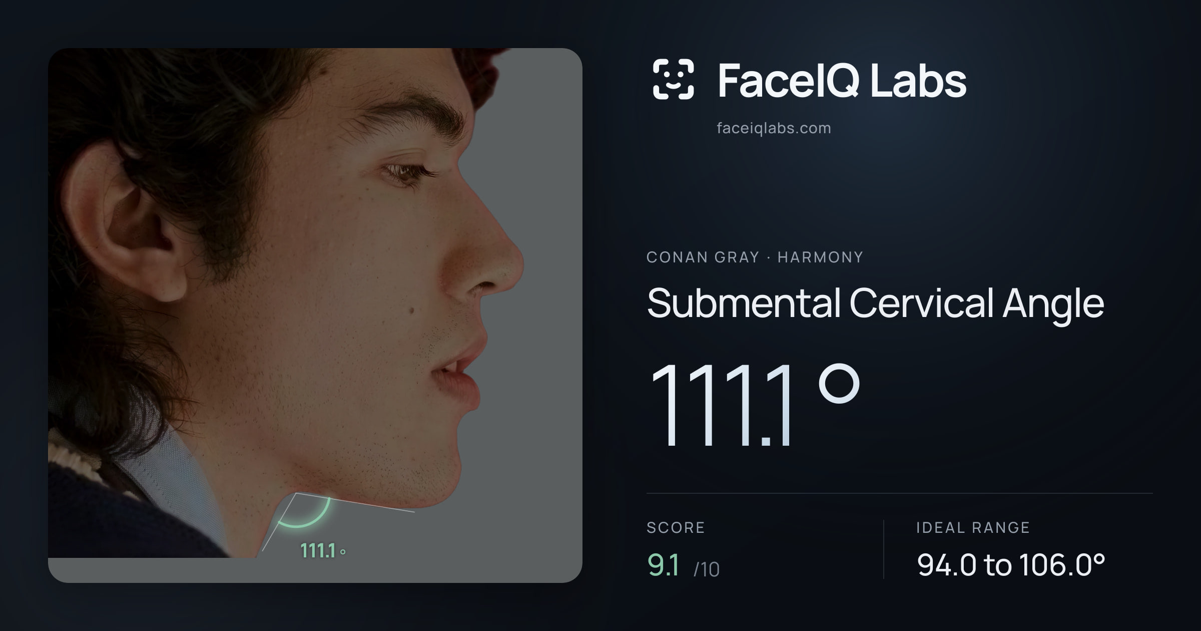 Conan Gray Submental Cervical Angle: 111.1°, drawn on the photo