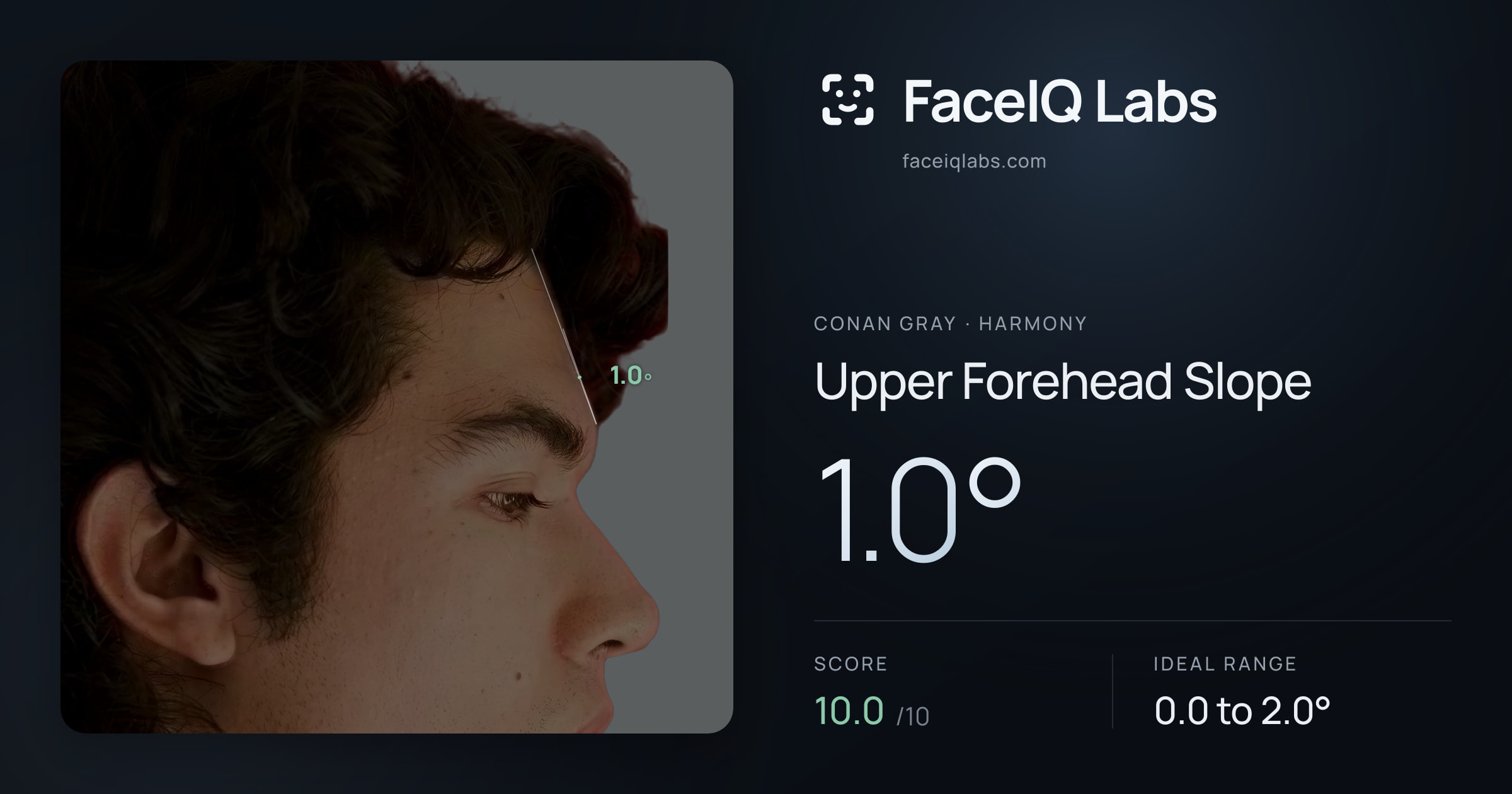 Conan Gray Upper Forehead Slope: 1.0°, drawn on the photo