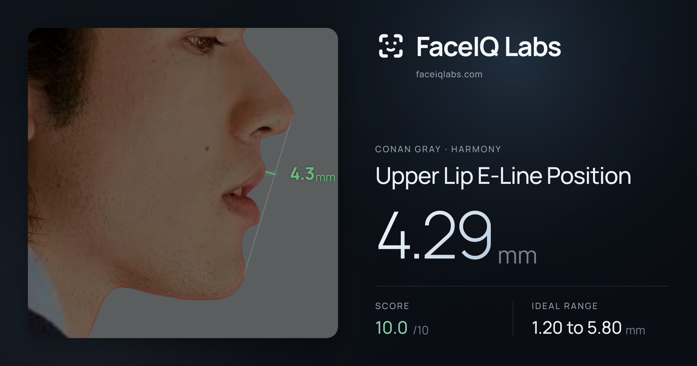 Conan Gray Upper Lip E-Line Position: 4.29mm, drawn on the photo