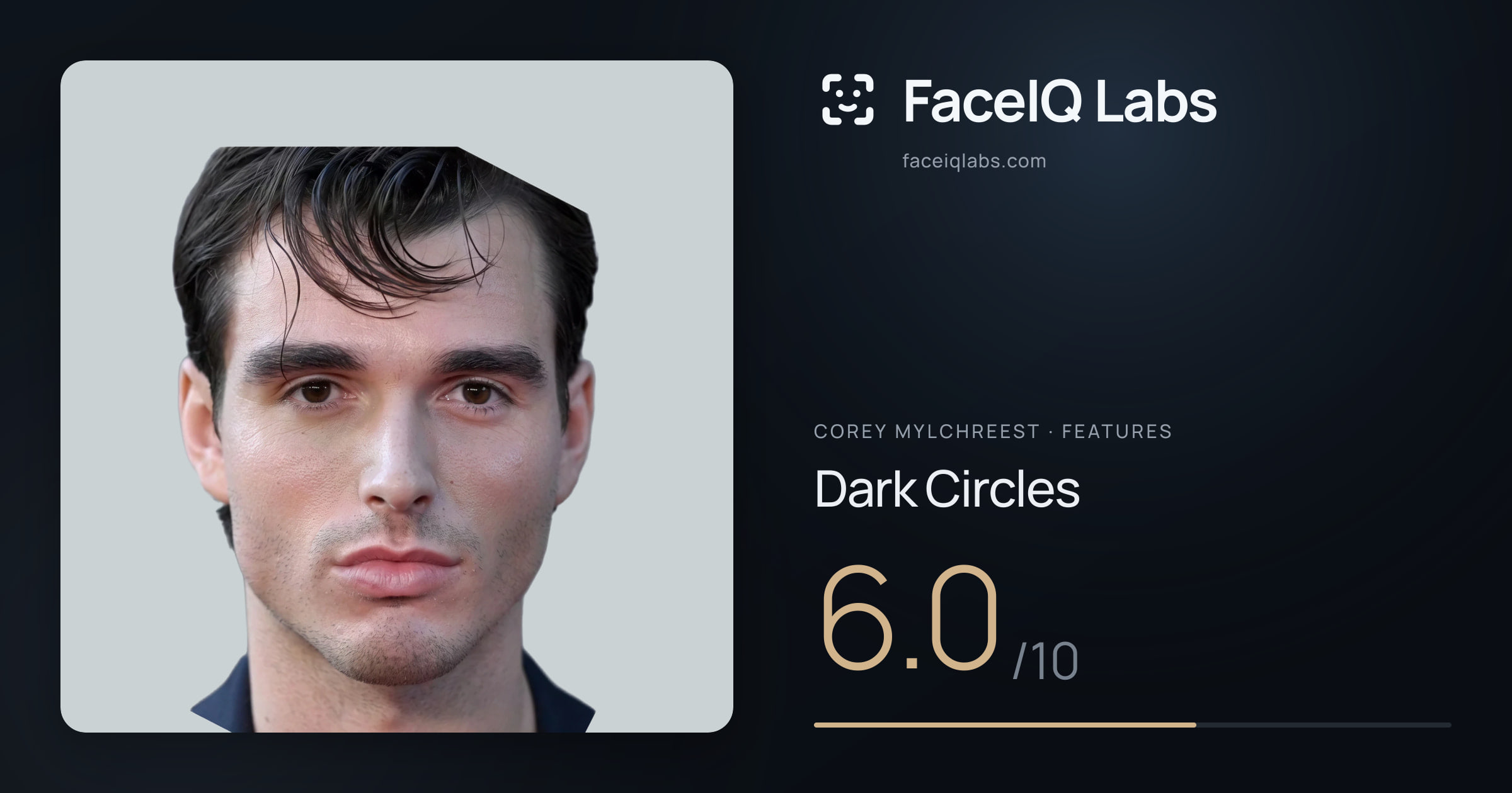 Corey Mylchreest Dark Circles: 6.0/10, drawn on the photo