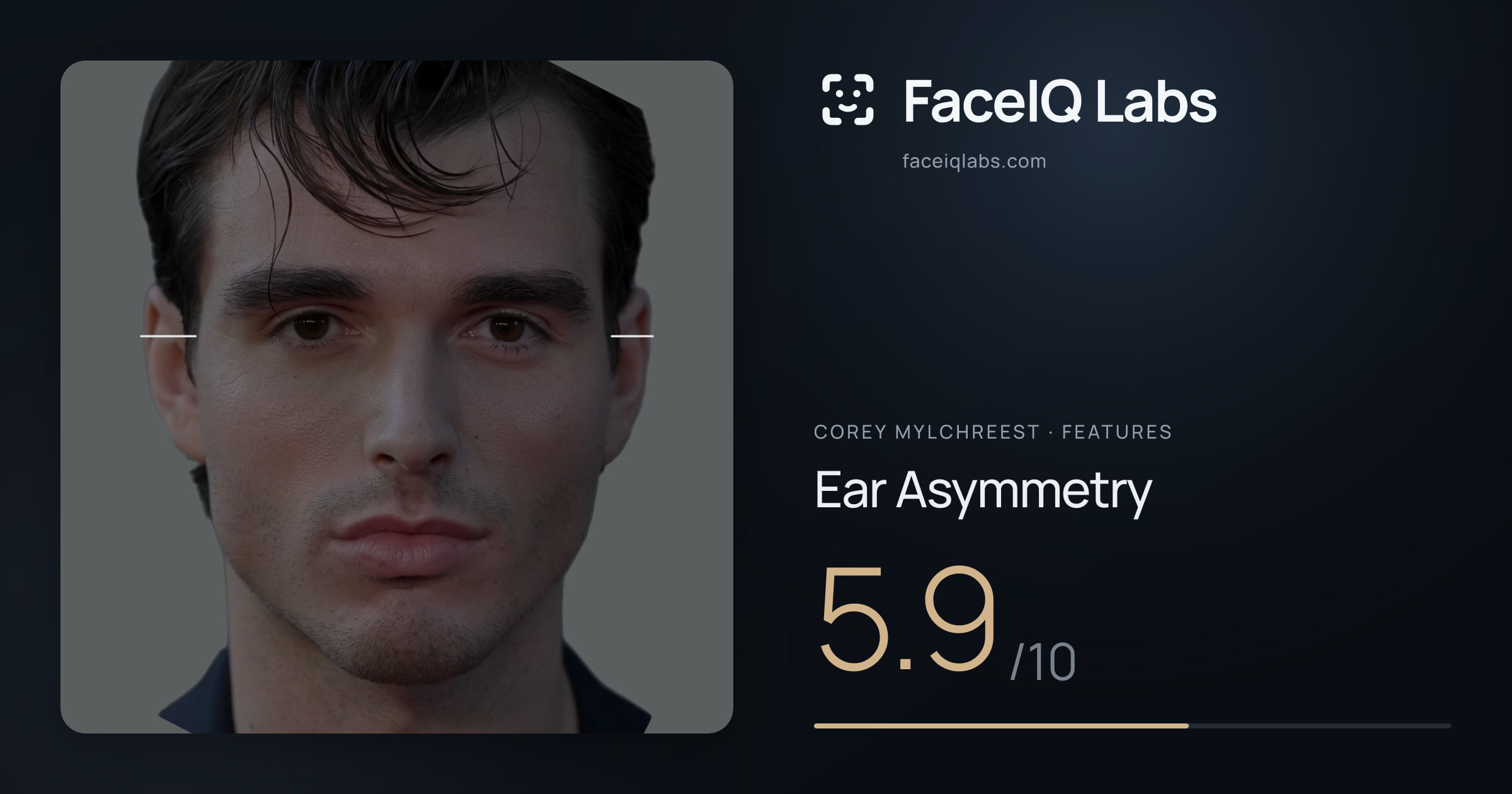 Corey Mylchreest Ear Asymmetry: 5.9/10, drawn on the photo