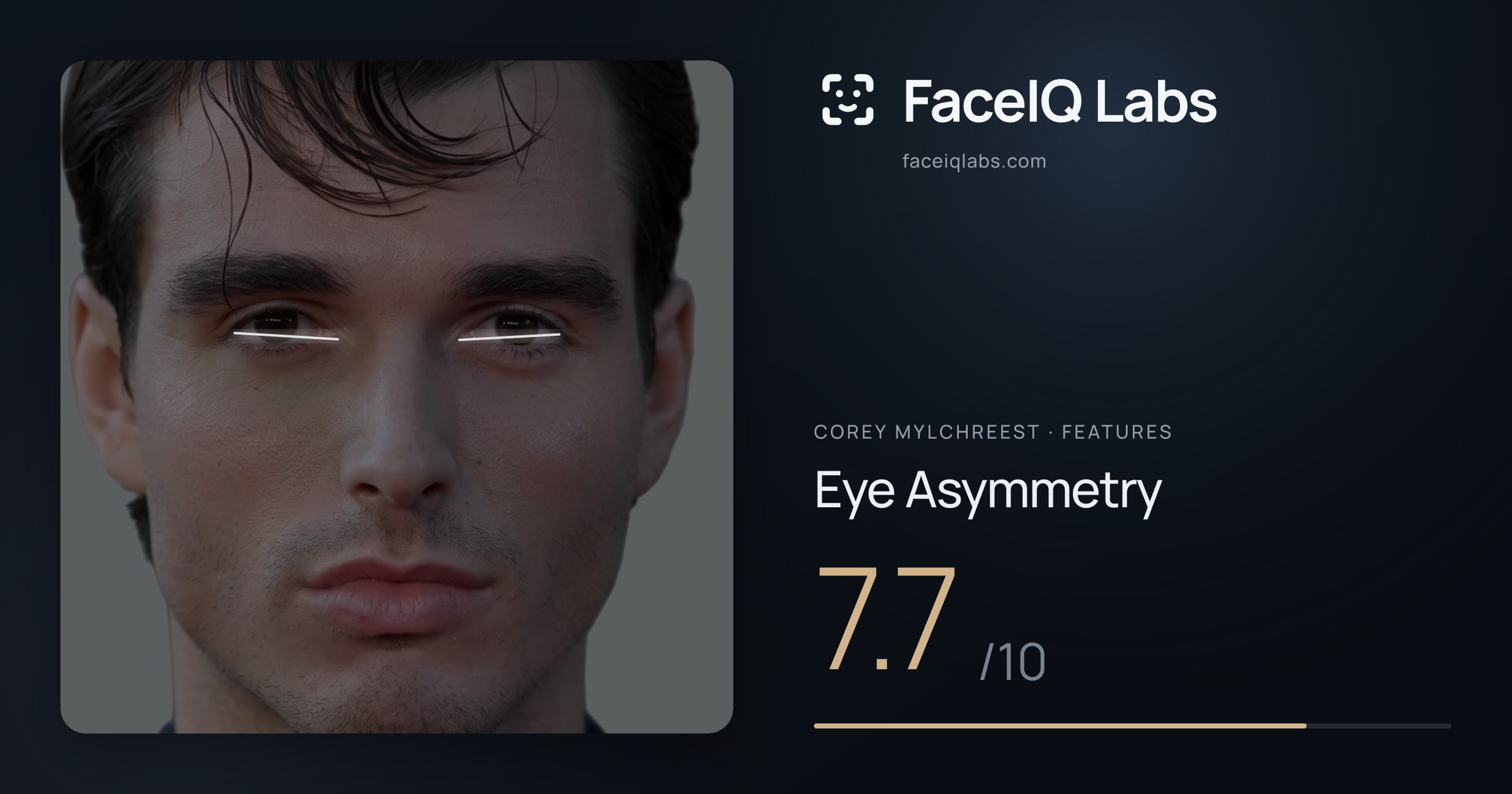 Corey Mylchreest Eye Asymmetry: 7.7/10, drawn on the photo