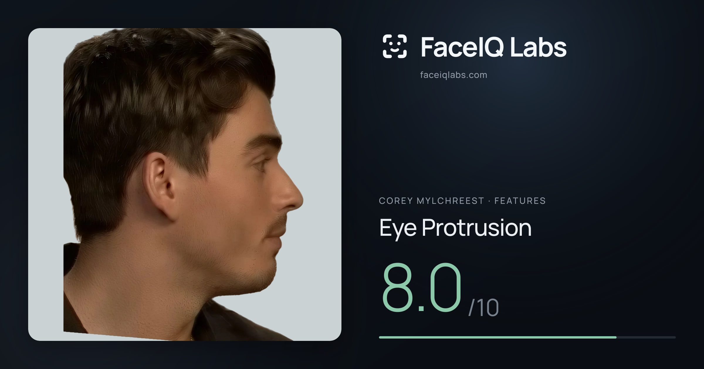 Corey Mylchreest Eye Protrusion: 8.0/10, drawn on the photo