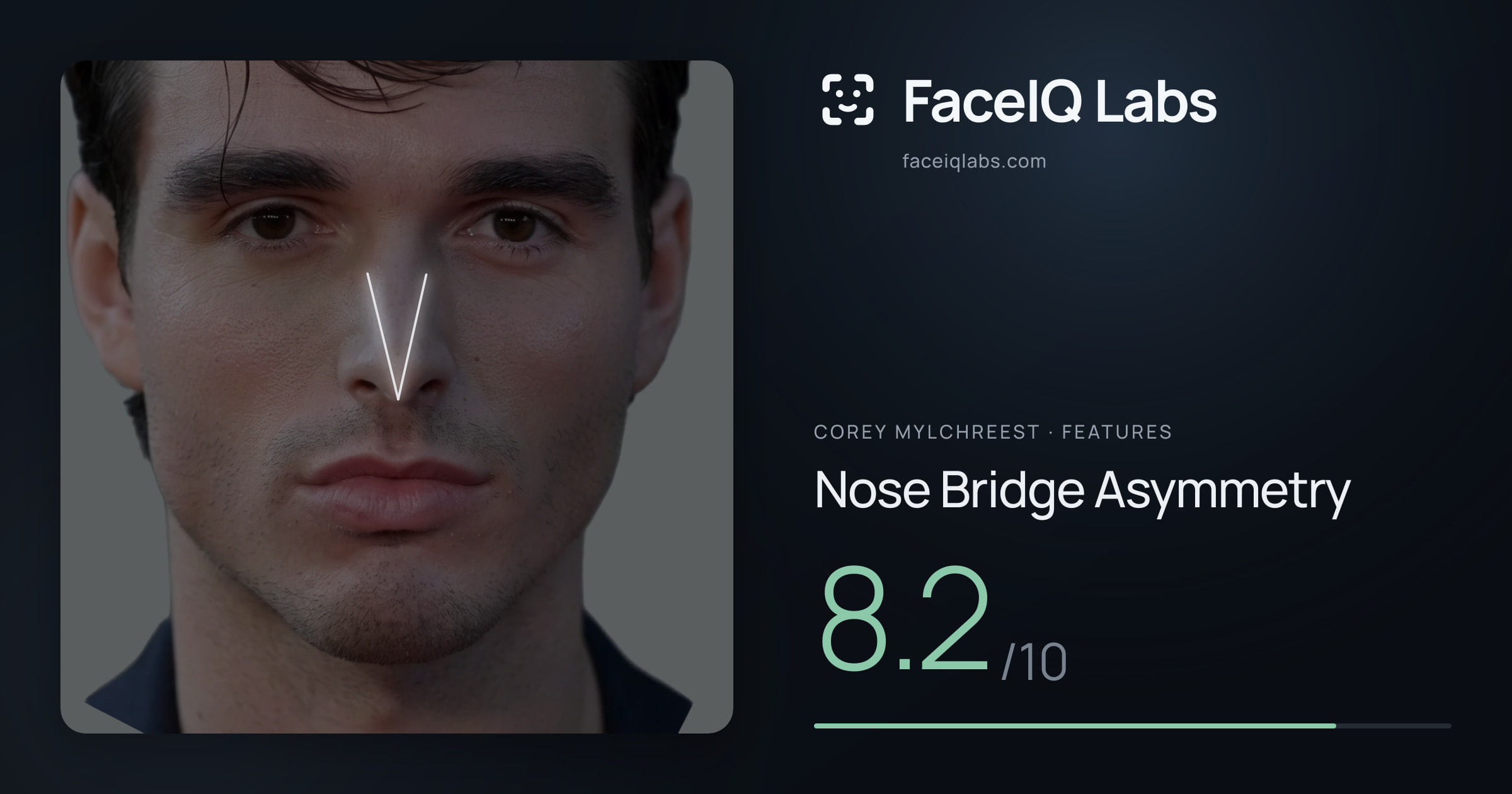 Corey Mylchreest Nose Bridge Asymmetry: 8.2/10, drawn on the photo