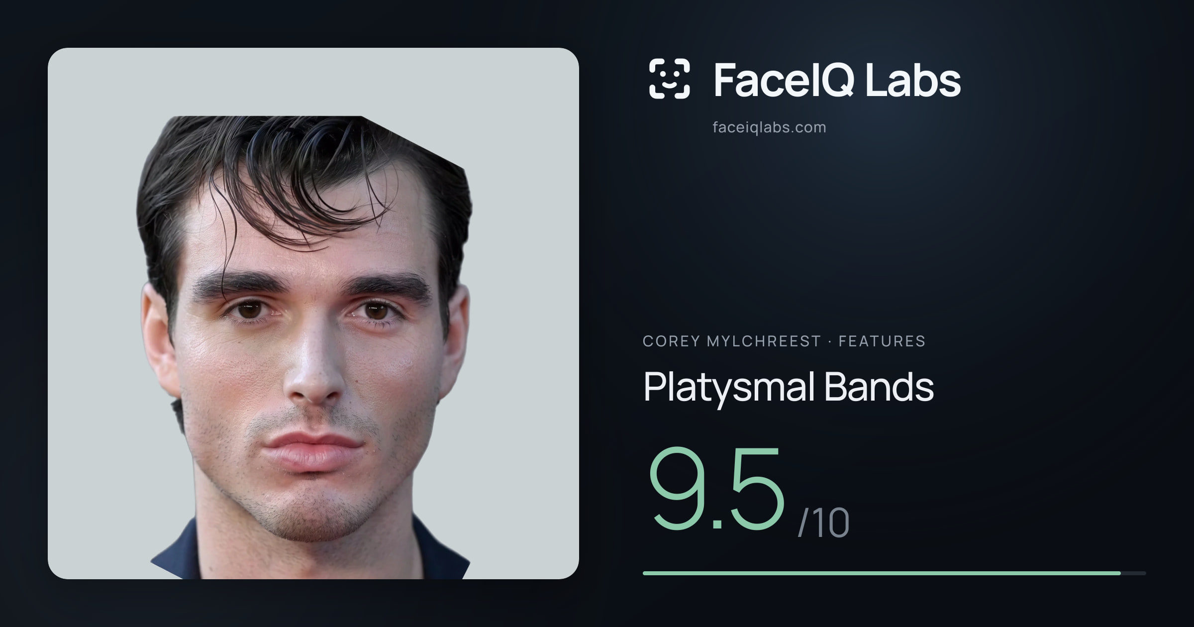 Corey Mylchreest Platysmal Bands: 9.5/10, drawn on the photo