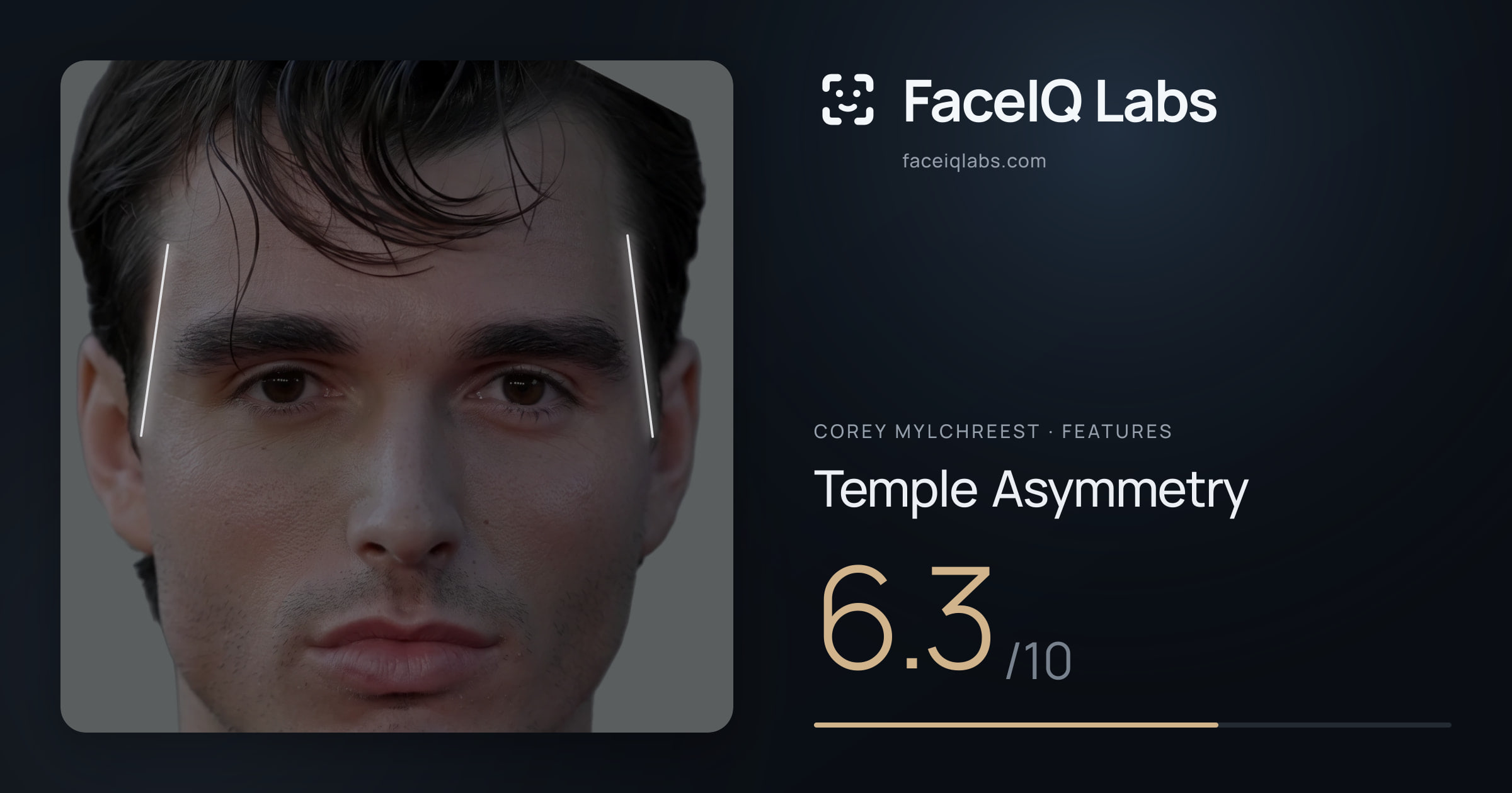 Corey Mylchreest Temple Asymmetry: 6.3/10, drawn on the photo