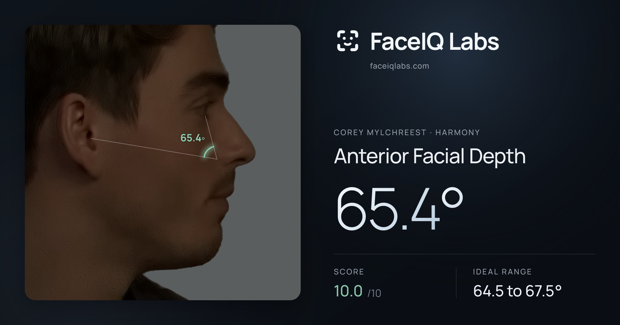 Corey Mylchreest Anterior Facial Depth: 65.4°, drawn on the photo
