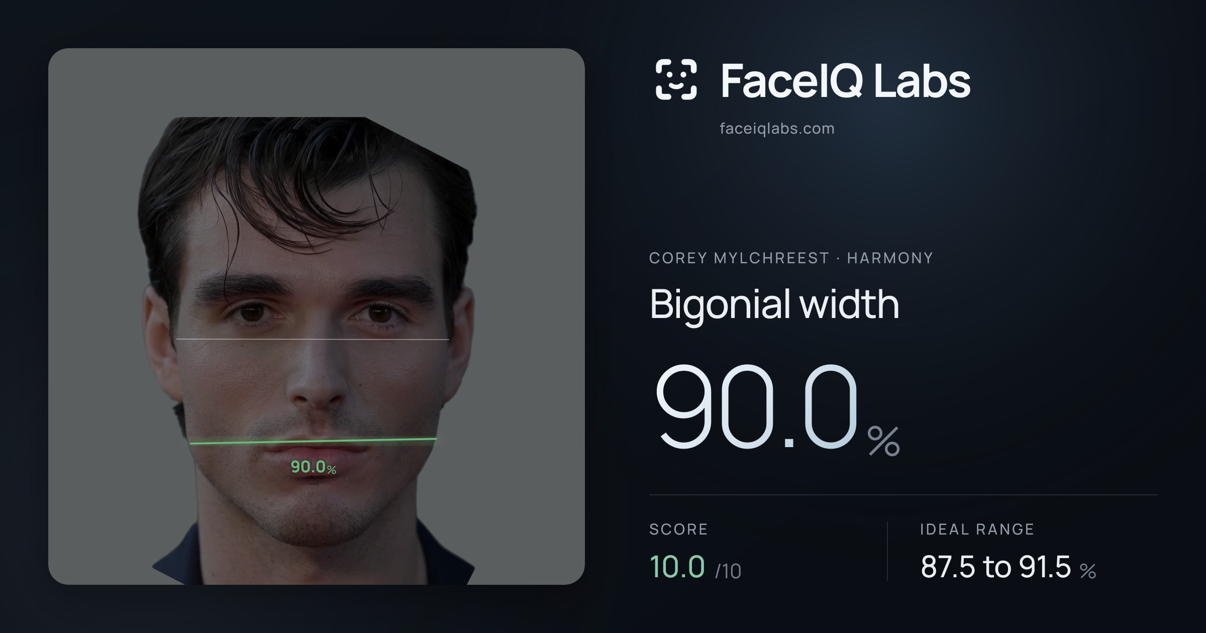 Corey Mylchreest Bigonial width: 90.0%, drawn on the photo