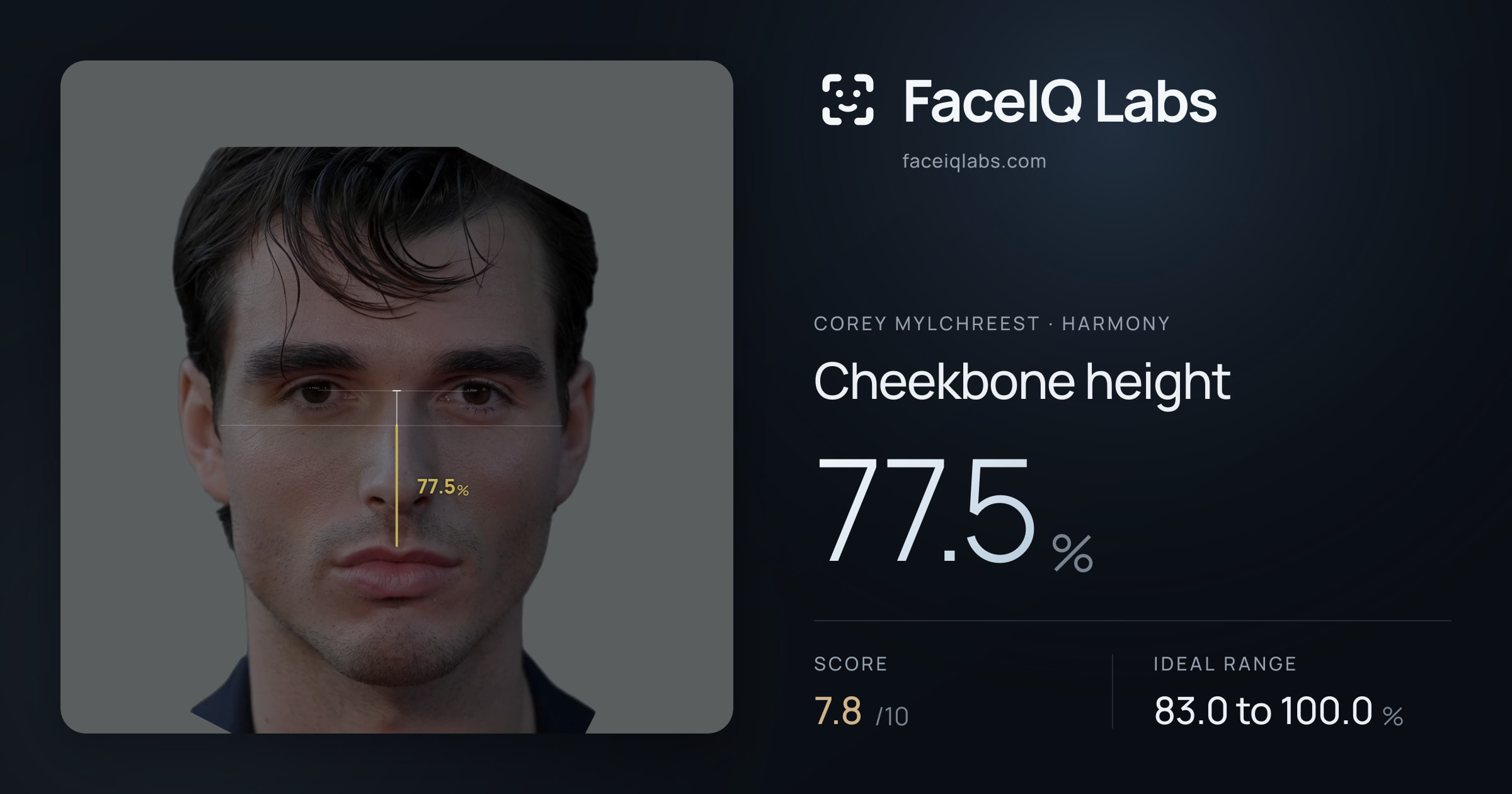Corey Mylchreest Cheekbone height: 77.5%, drawn on the photo