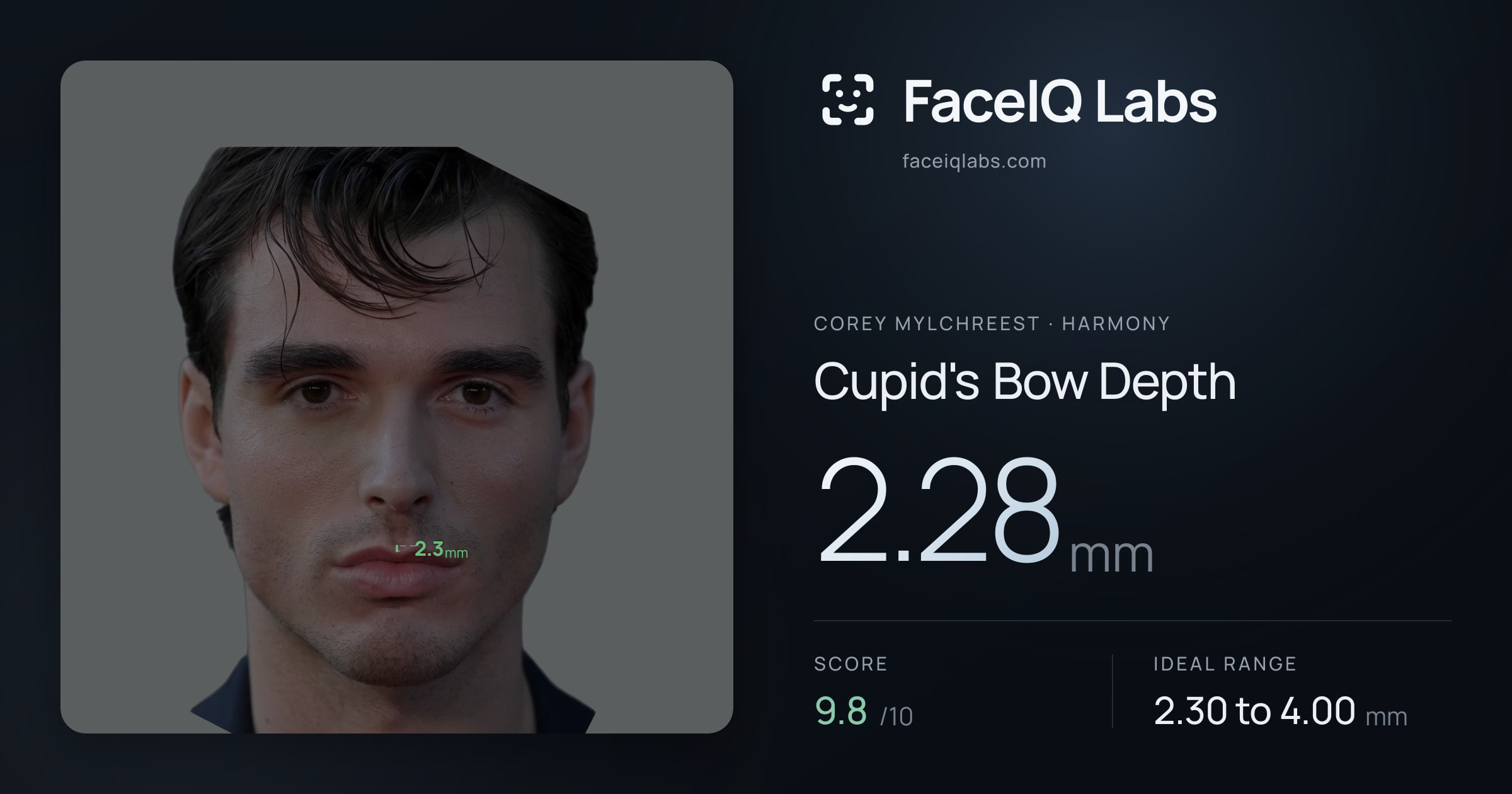 Corey Mylchreest Cupid's Bow Depth: 2.28mm, drawn on the photo