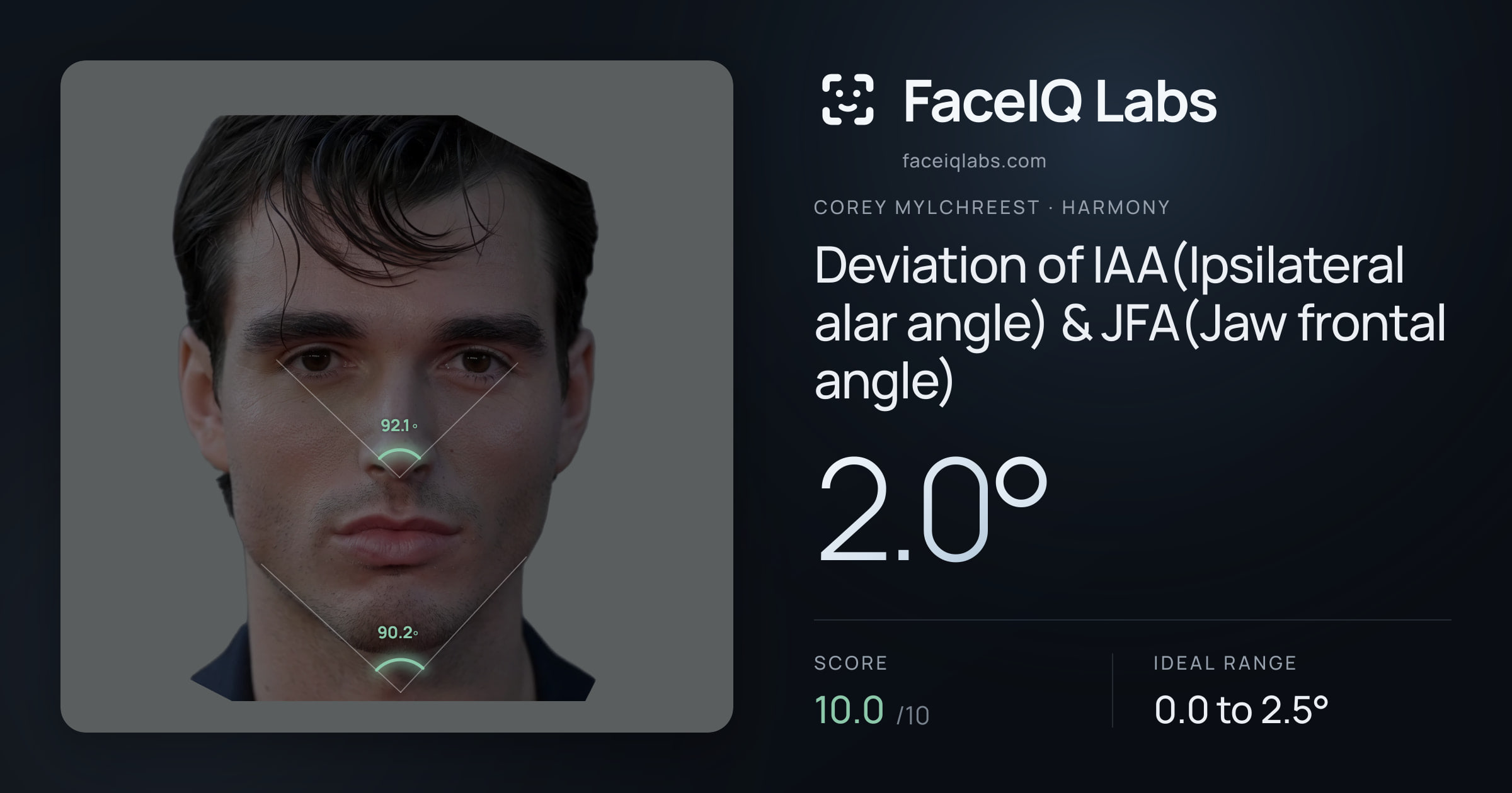 Corey Mylchreest Deviation of IAA(Ipsilateral alar angle) & JFA(Jaw frontal angle): 2.0°, drawn on the photo