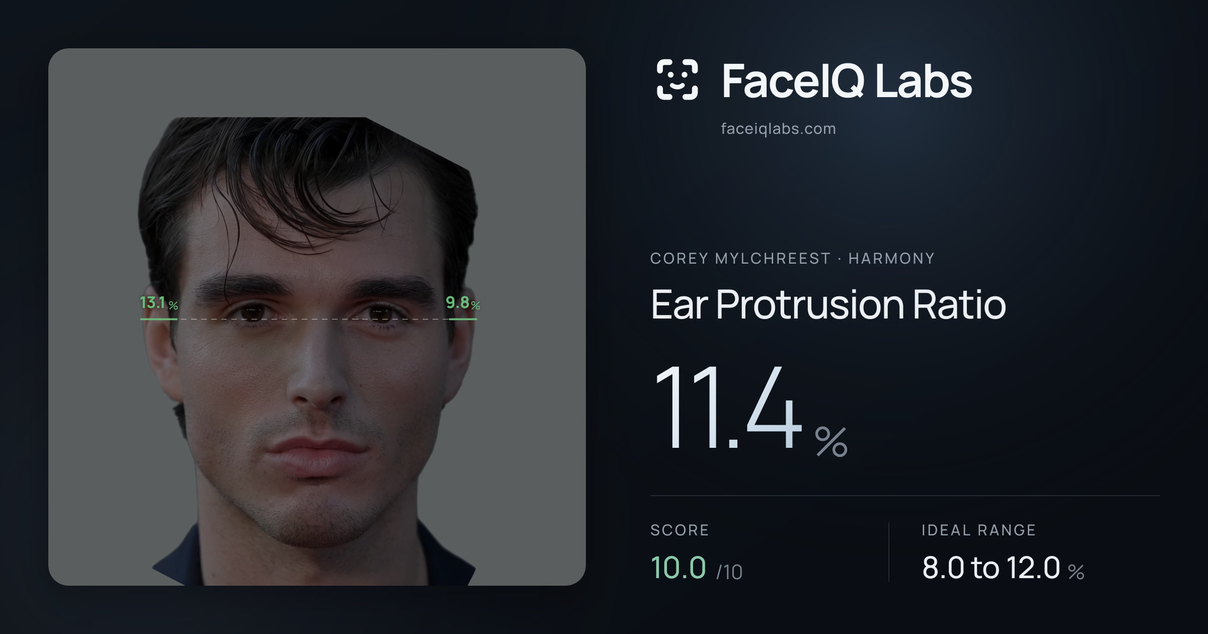 Corey Mylchreest Ear Protrusion Ratio: 11.4%, drawn on the photo