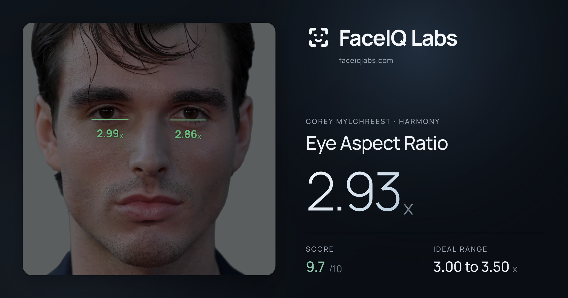 Corey Mylchreest Eye Aspect Ratio: 2.93x, drawn on the photo