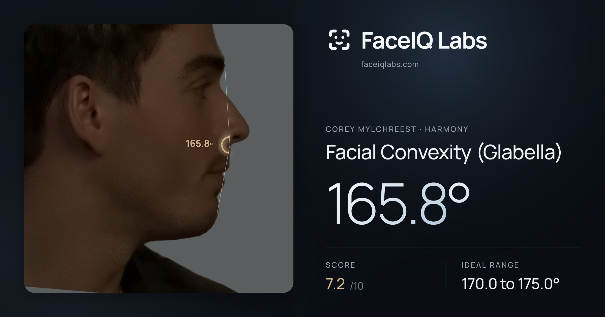 Corey Mylchreest Facial Convexity (Glabella): 165.8°, drawn on the photo