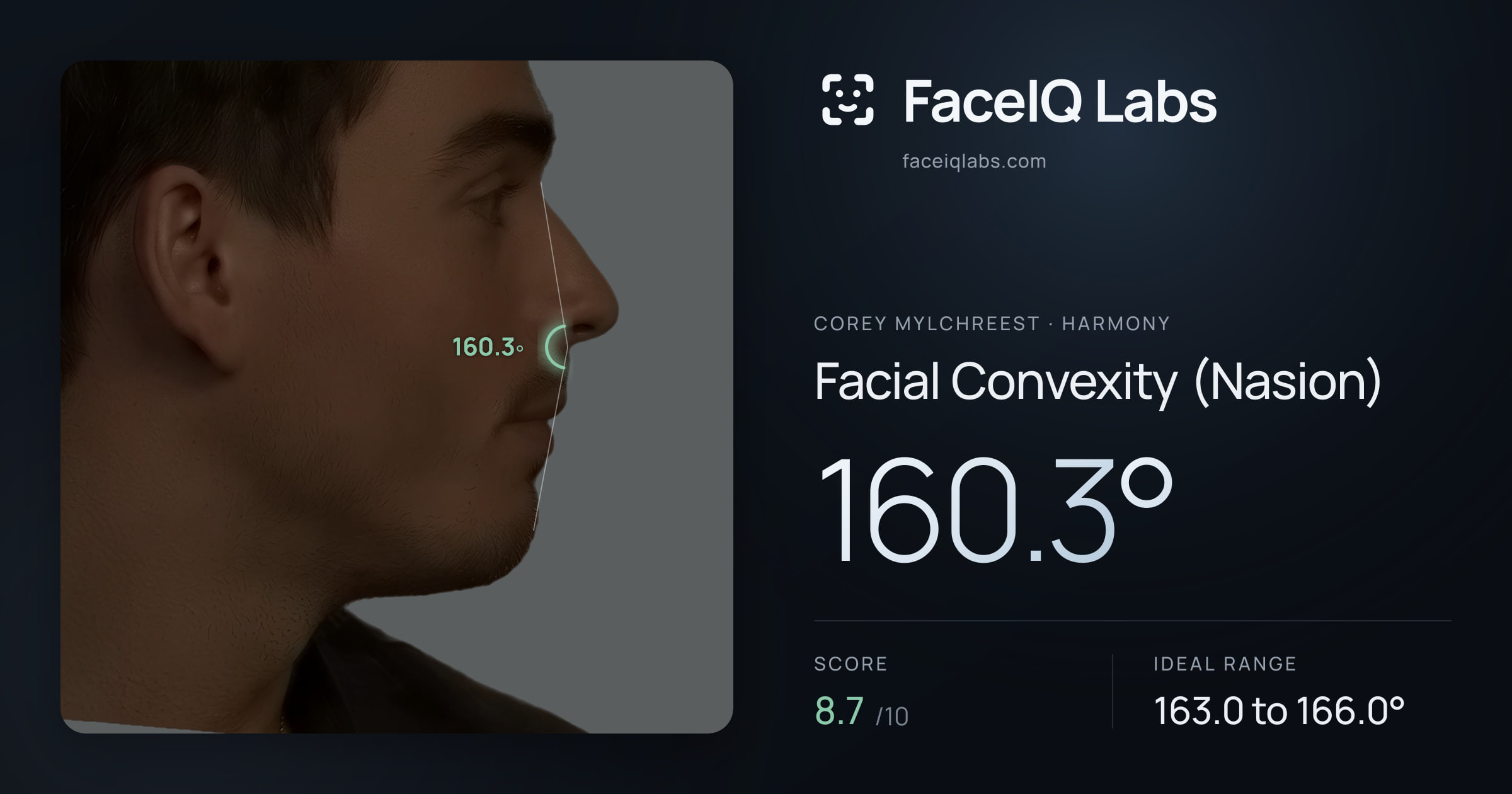 Corey Mylchreest Facial Convexity (Nasion): 160.3°, drawn on the photo