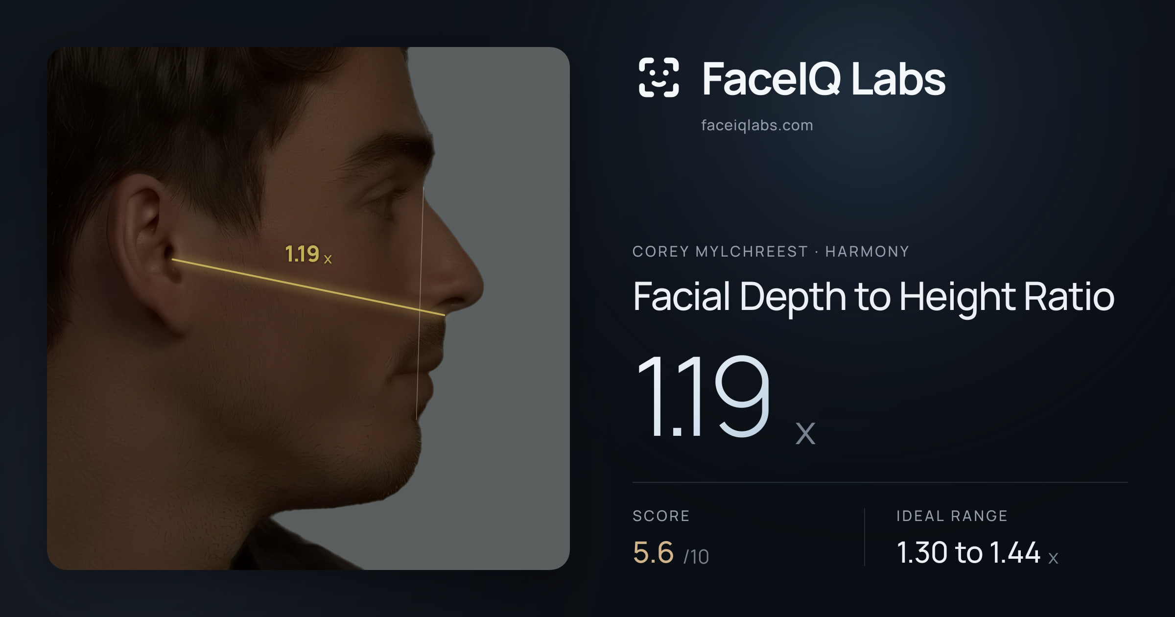 Corey Mylchreest Facial Depth to Height Ratio: 1.19x, drawn on the photo