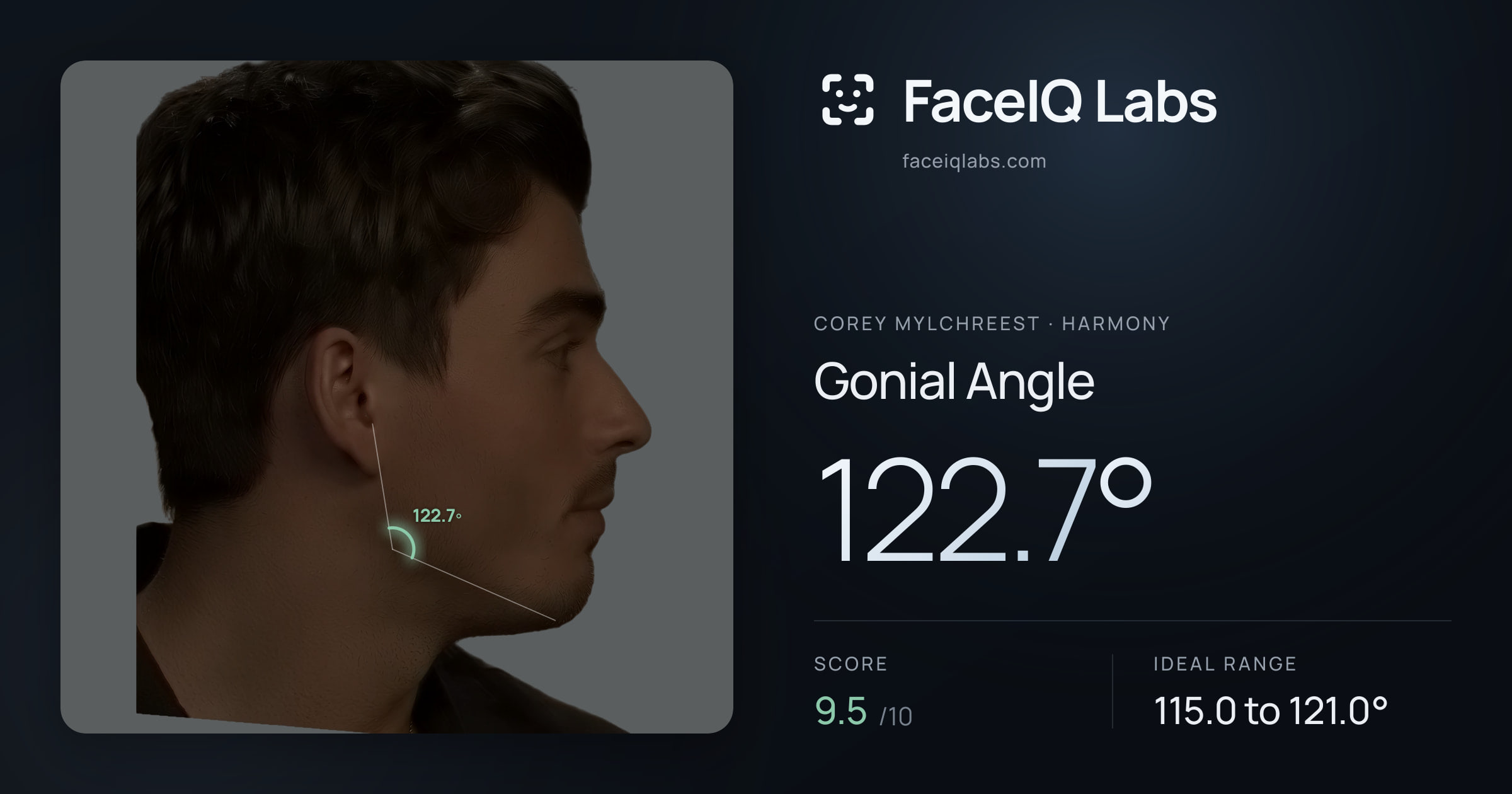 Corey Mylchreest Gonial Angle: 122.7°, drawn on the photo