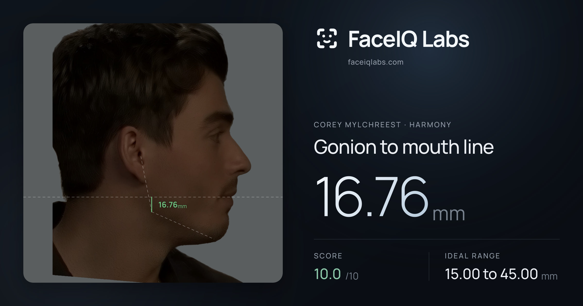Corey Mylchreest Gonion to mouth line: 16.76mm, drawn on the photo