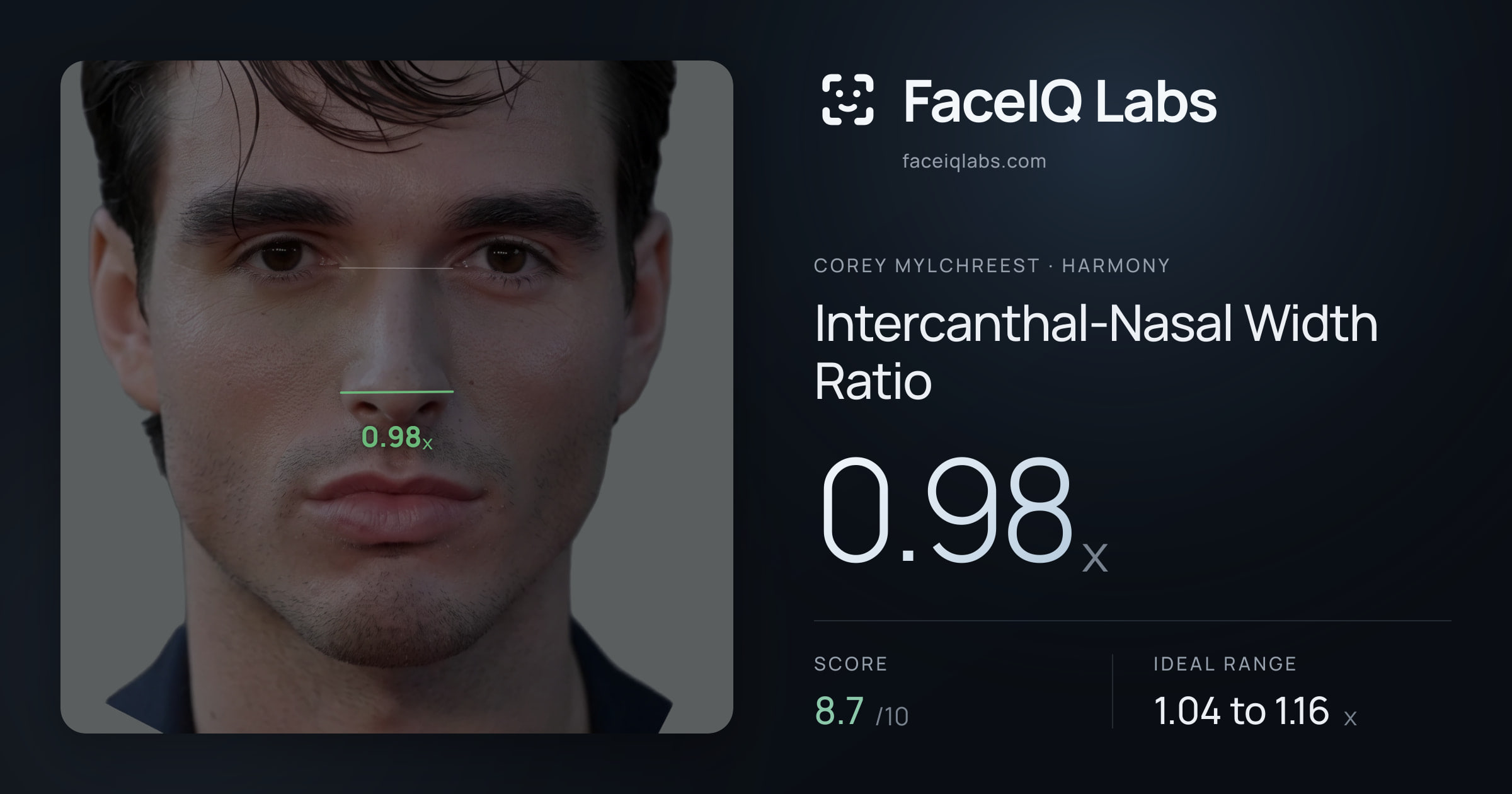 Corey Mylchreest Intercanthal-Nasal Width Ratio: 0.98x, drawn on the photo