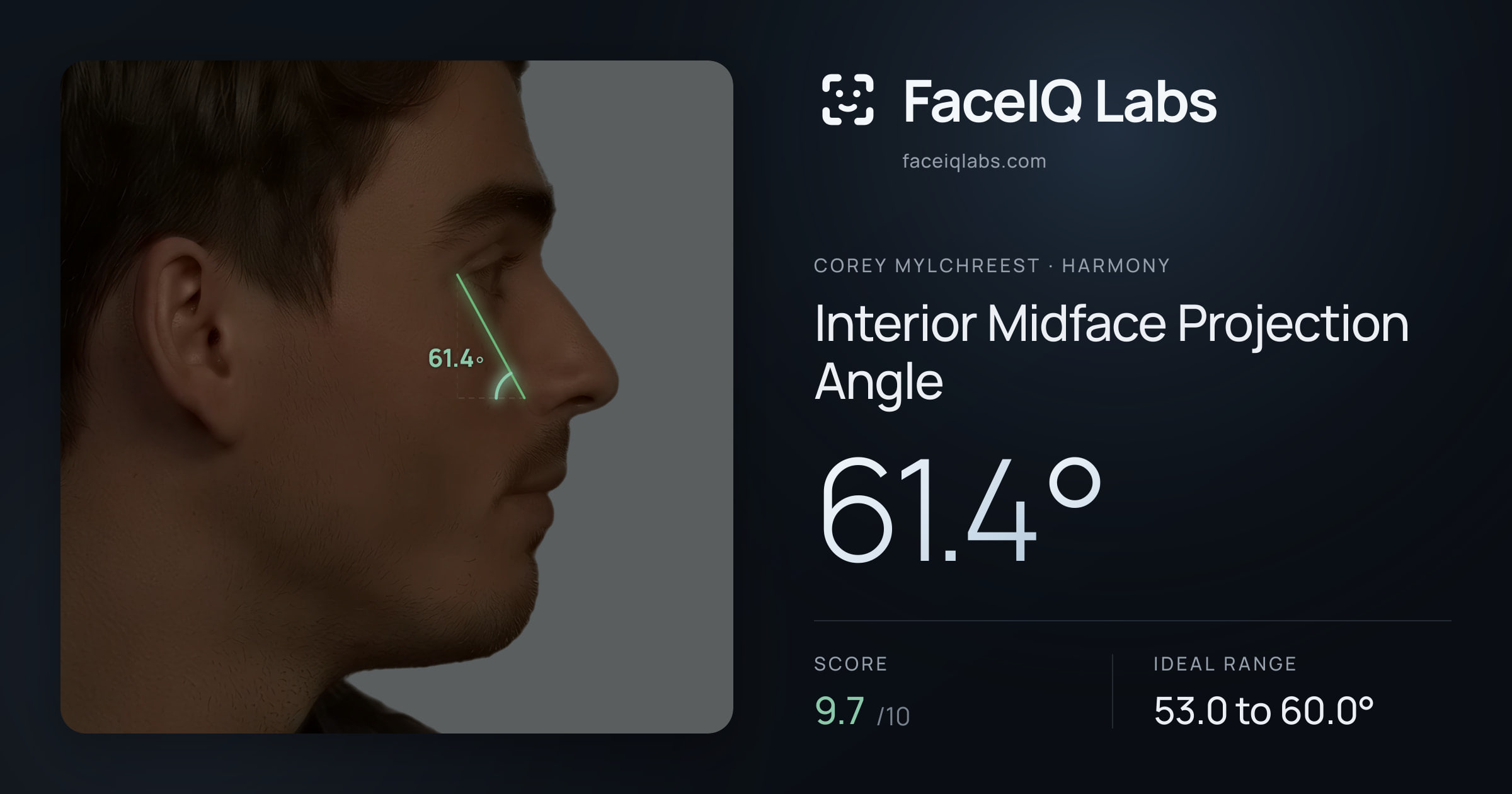 Corey Mylchreest Interior Midface Projection Angle: 61.4°, drawn on the photo