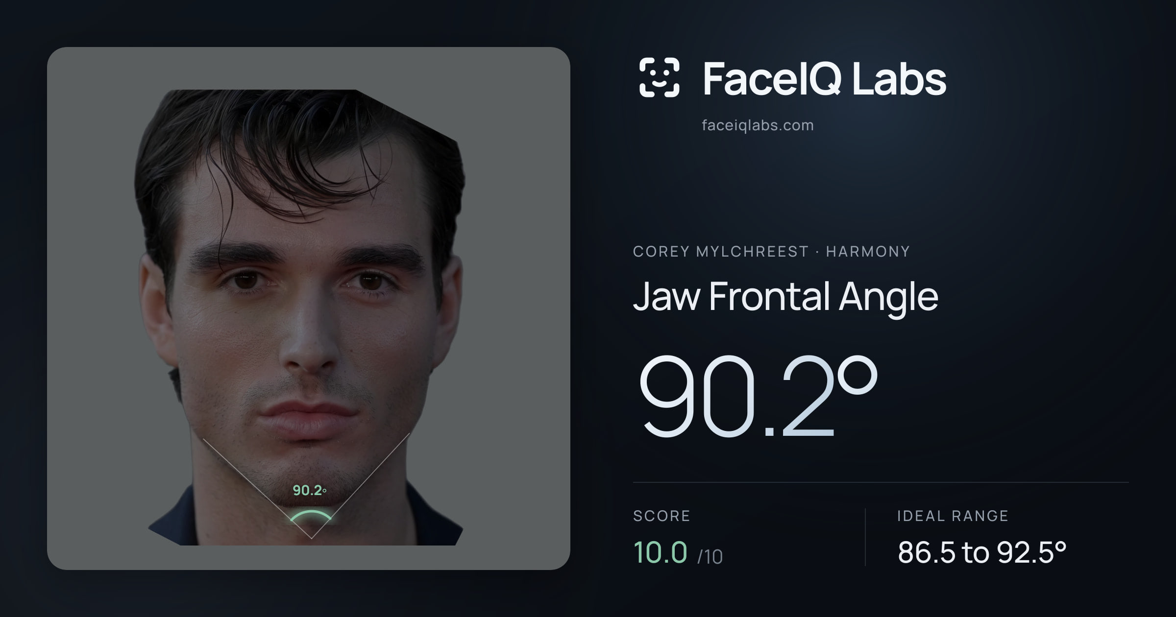 Corey Mylchreest Jaw Frontal Angle: 90.2°, drawn on the photo