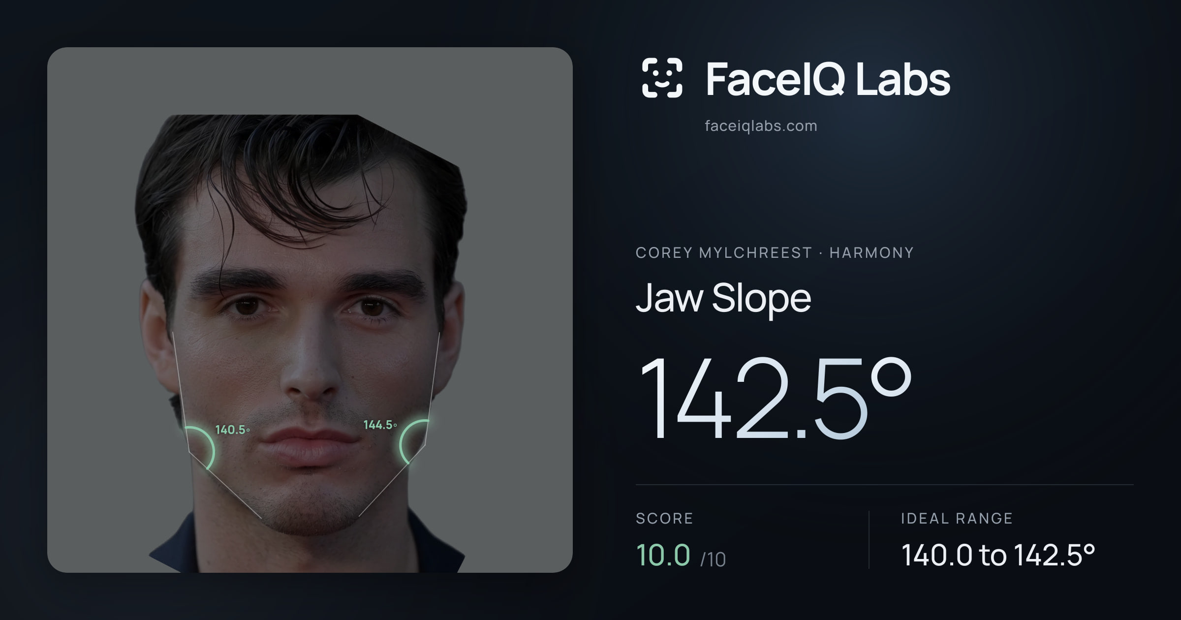 Corey Mylchreest Jaw Slope: 142.5°, drawn on the photo