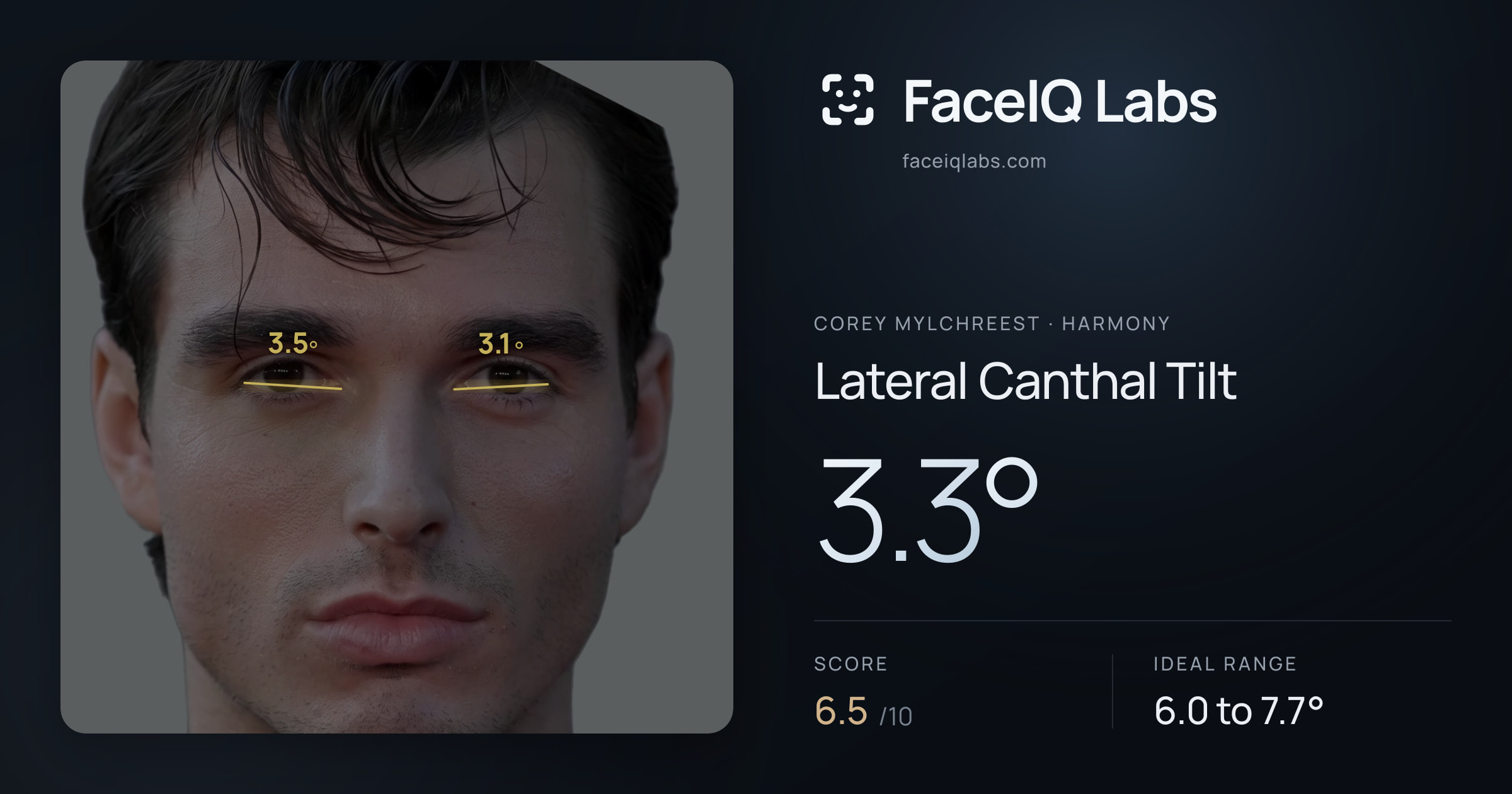 Corey Mylchreest Lateral Canthal Tilt: 3.3°, drawn on the photo