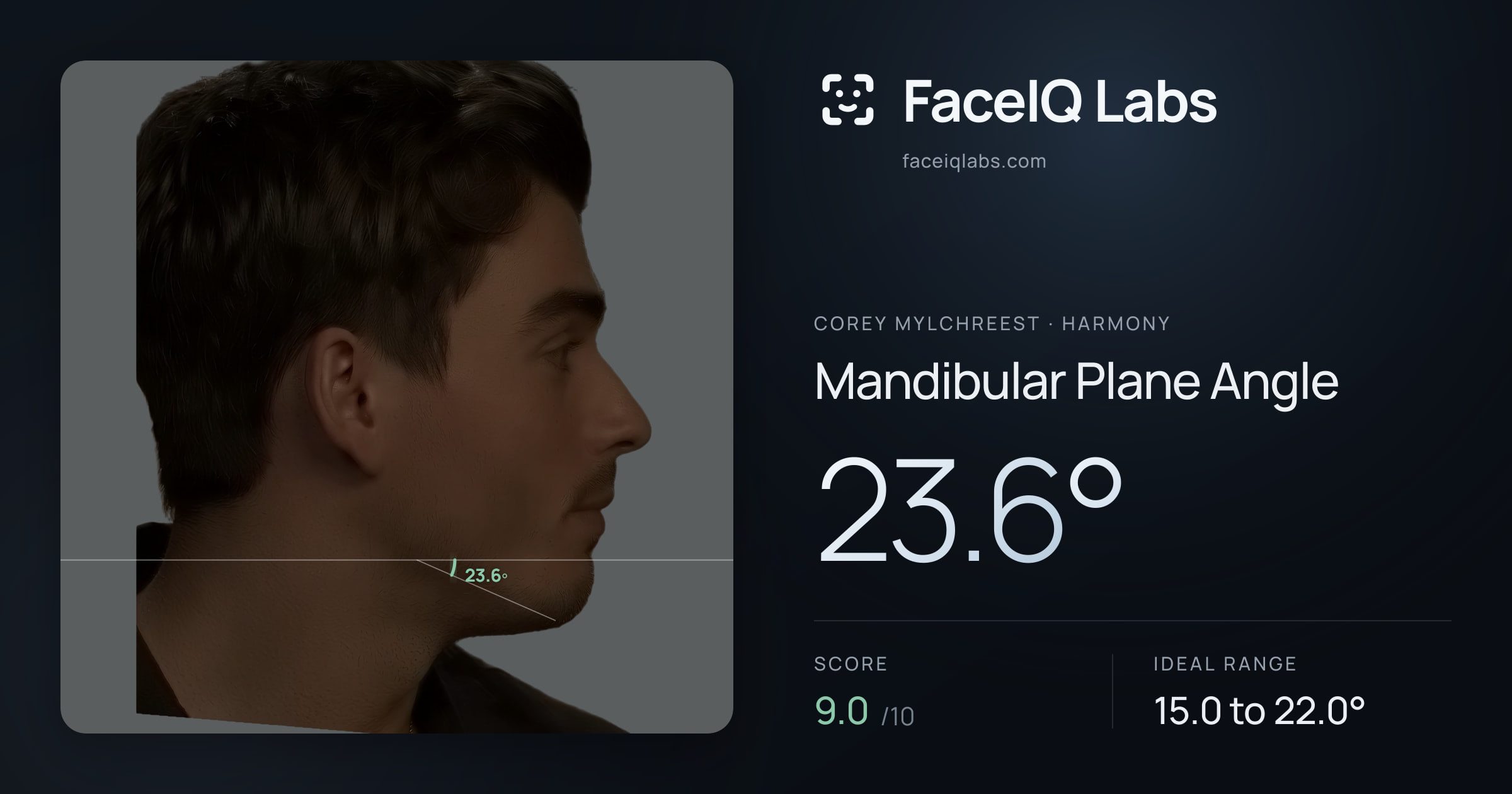 Corey Mylchreest Mandibular Plane Angle: 23.6°, drawn on the photo
