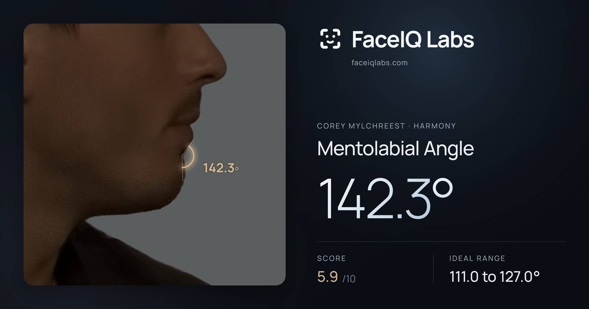 Corey Mylchreest Mentolabial Angle: 142.3°, drawn on the photo