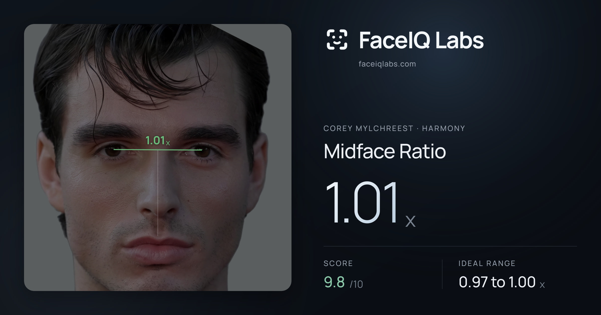 Corey Mylchreest Midface Ratio: 1.01x, drawn on the photo