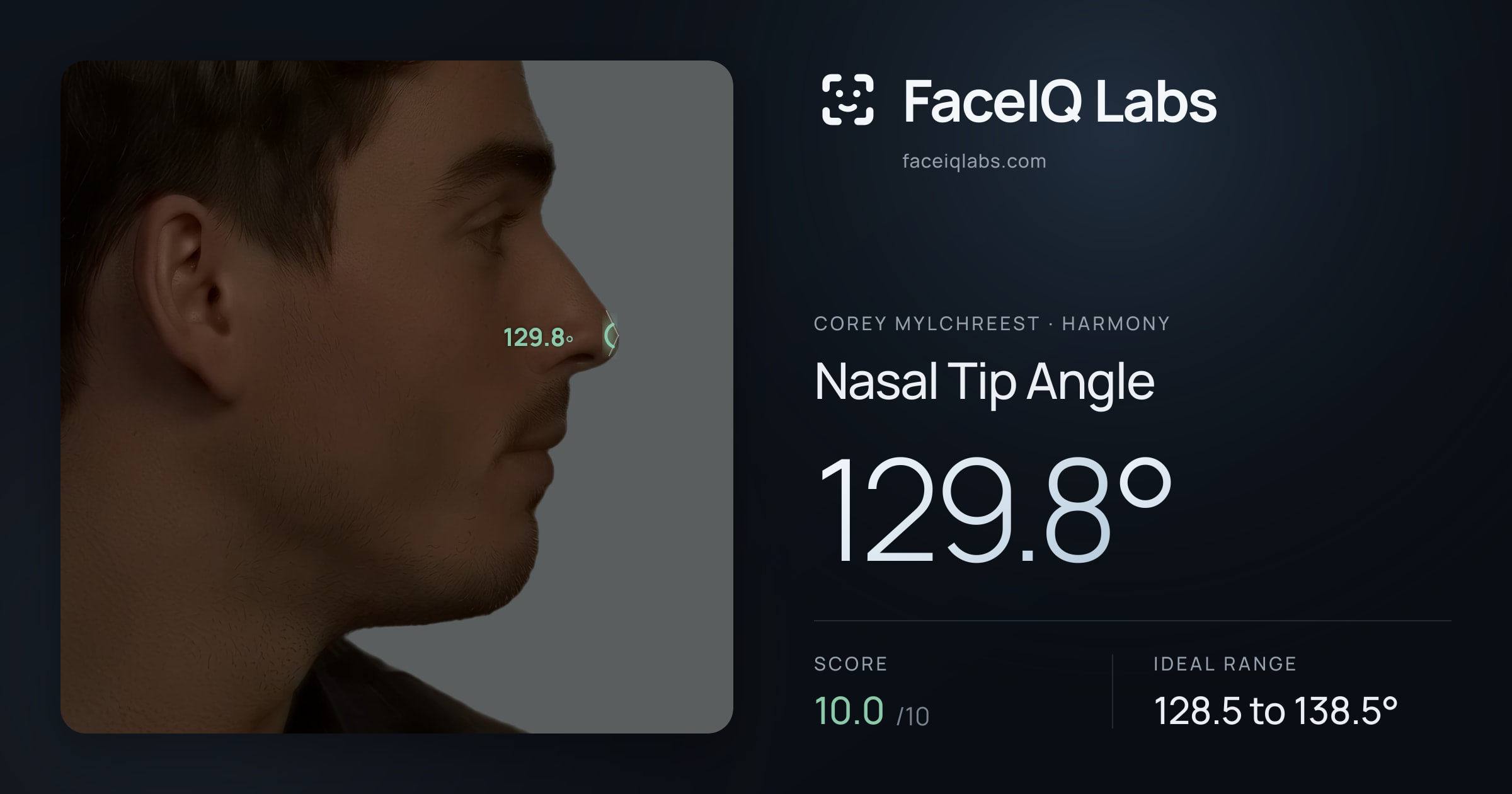 Corey Mylchreest Nasal Tip Angle: 129.8°, drawn on the photo