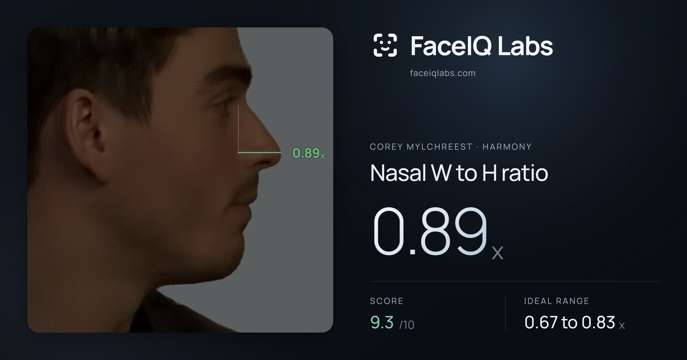 Corey Mylchreest Nasal W to H ratio: 0.89x, drawn on the photo
