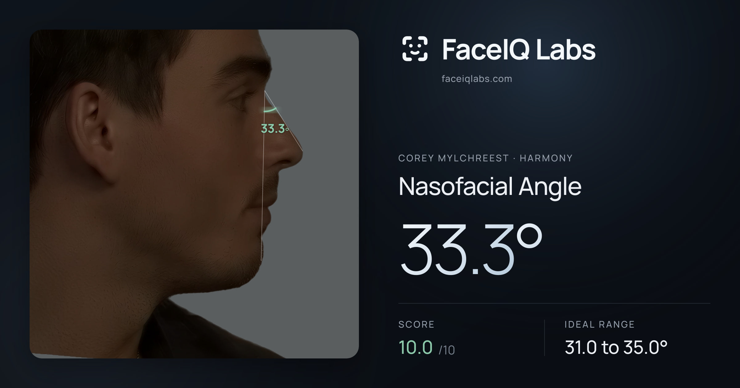 Corey Mylchreest Nasofacial Angle: 33.3°, drawn on the photo