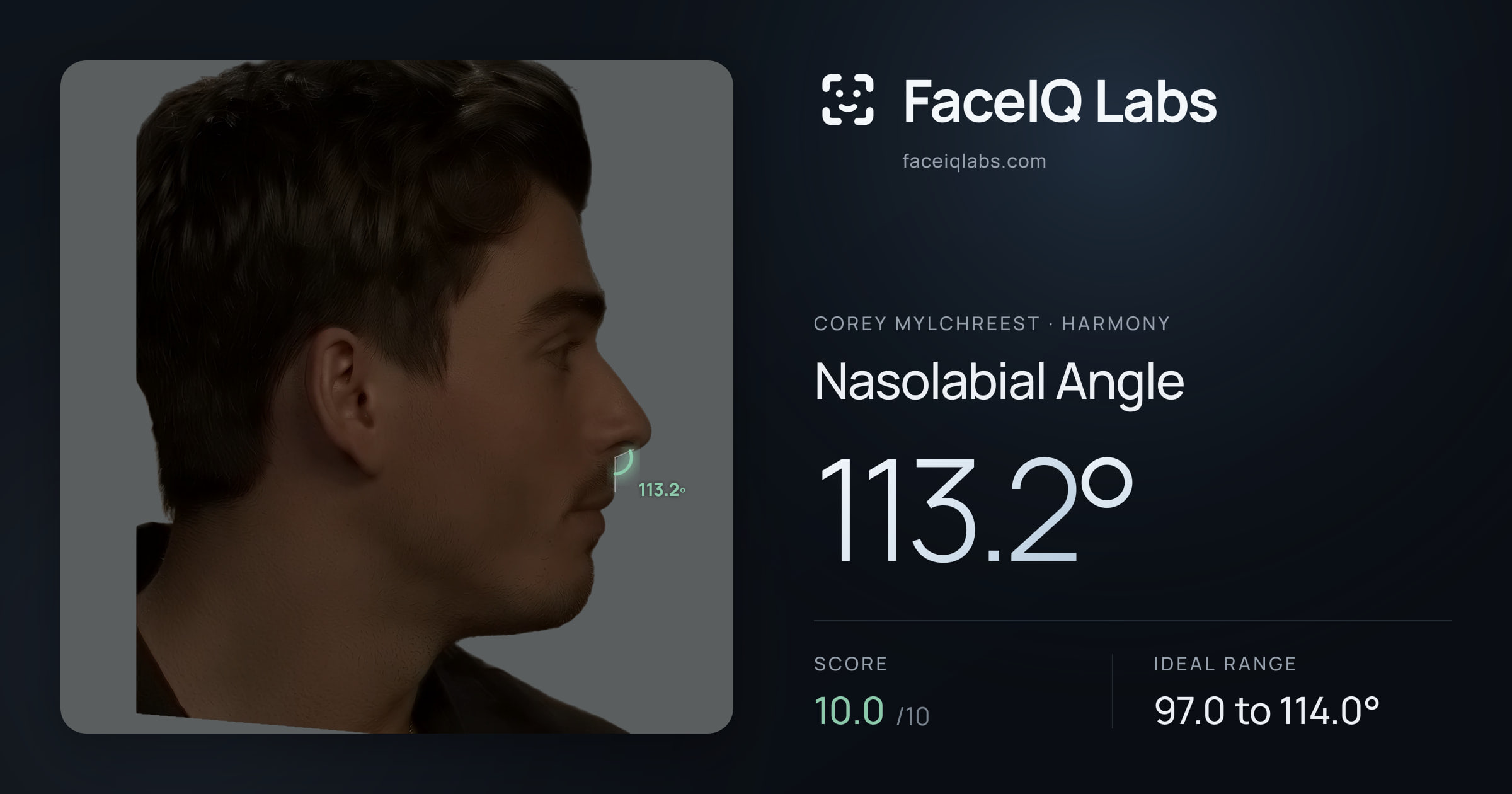 Corey Mylchreest Nasolabial Angle: 113.2°, drawn on the photo