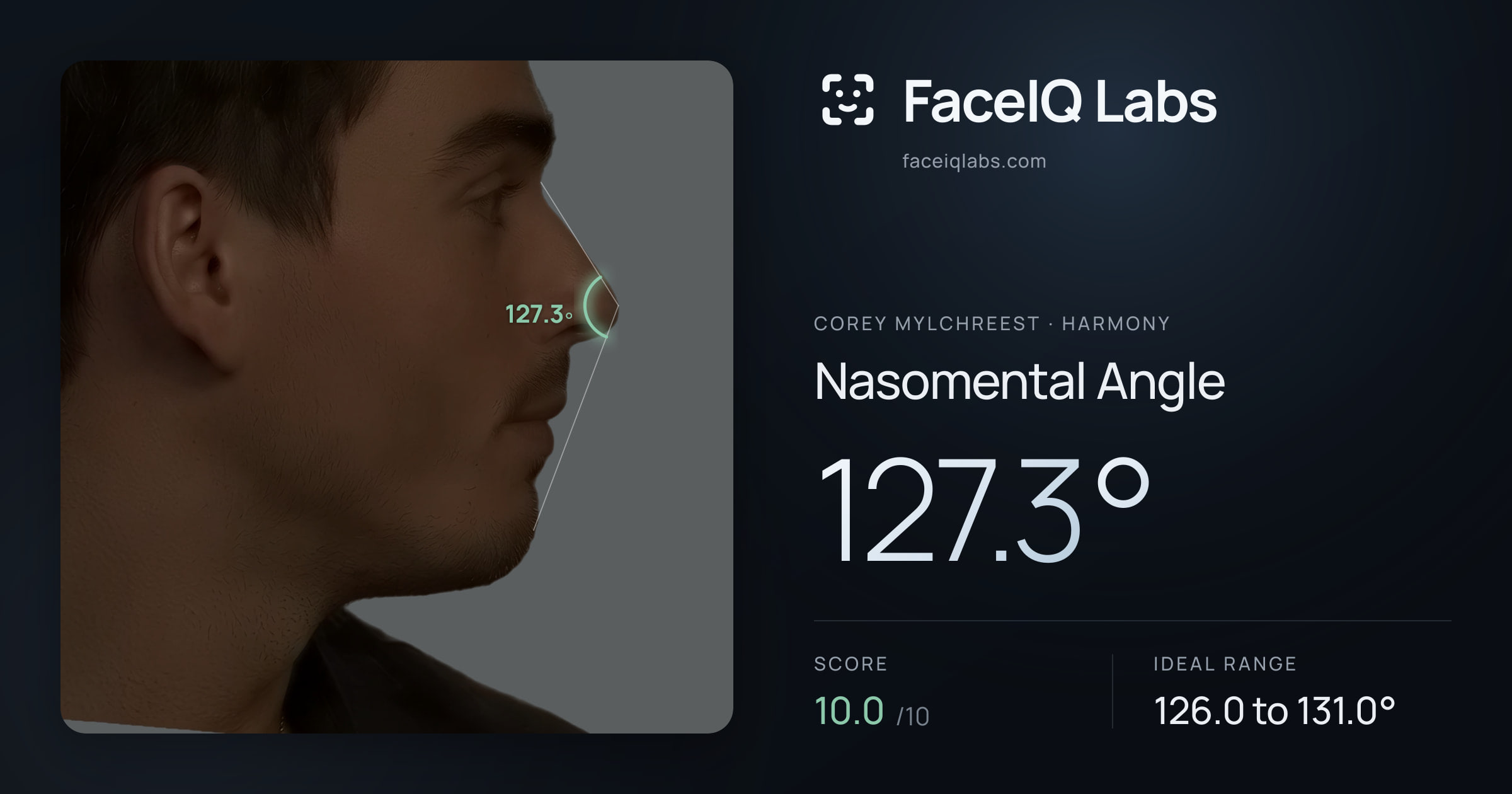 Corey Mylchreest Nasomental Angle: 127.3°, drawn on the photo