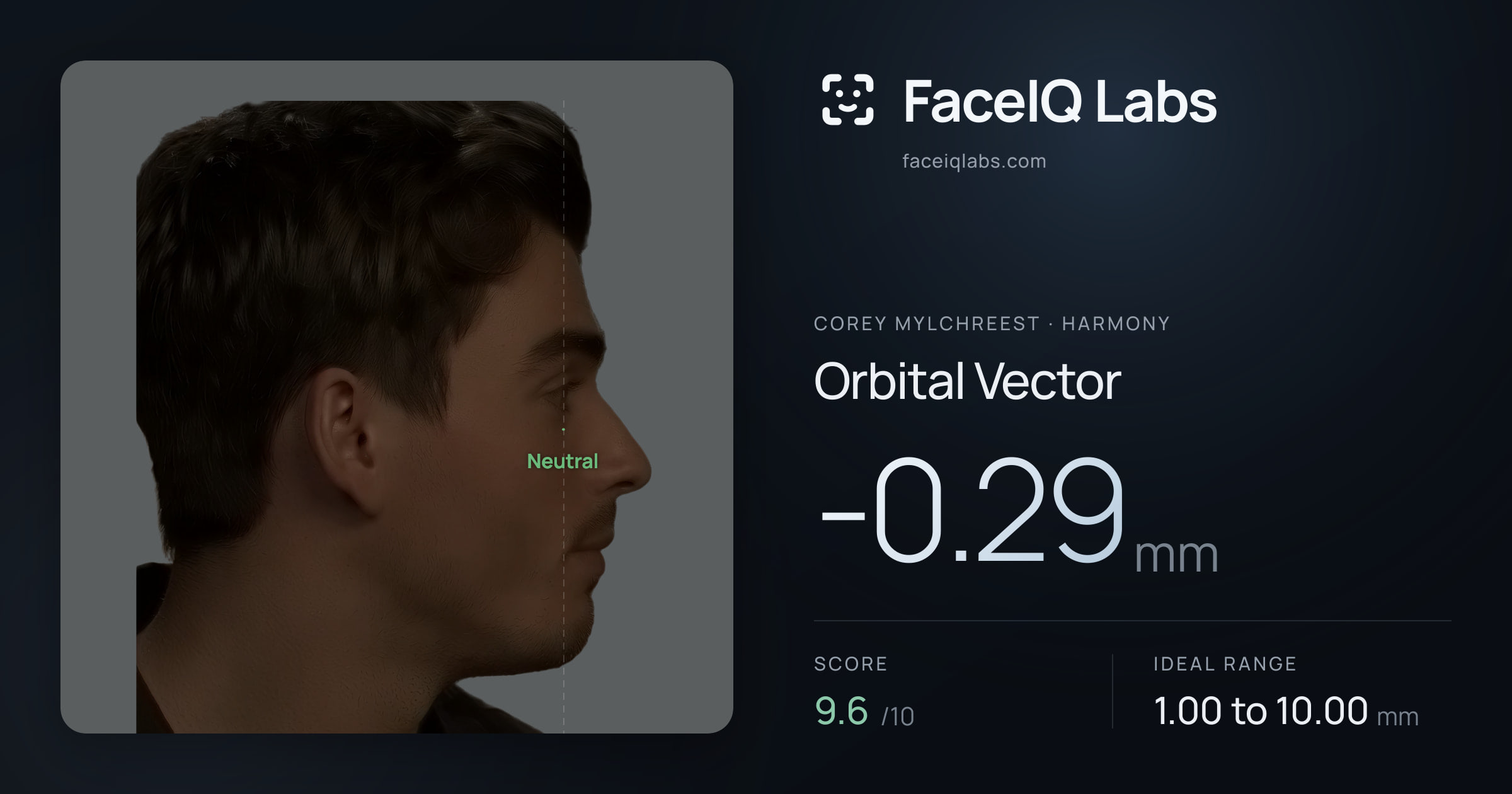 Corey Mylchreest Orbital Vector: -0.29mm, drawn on the photo
