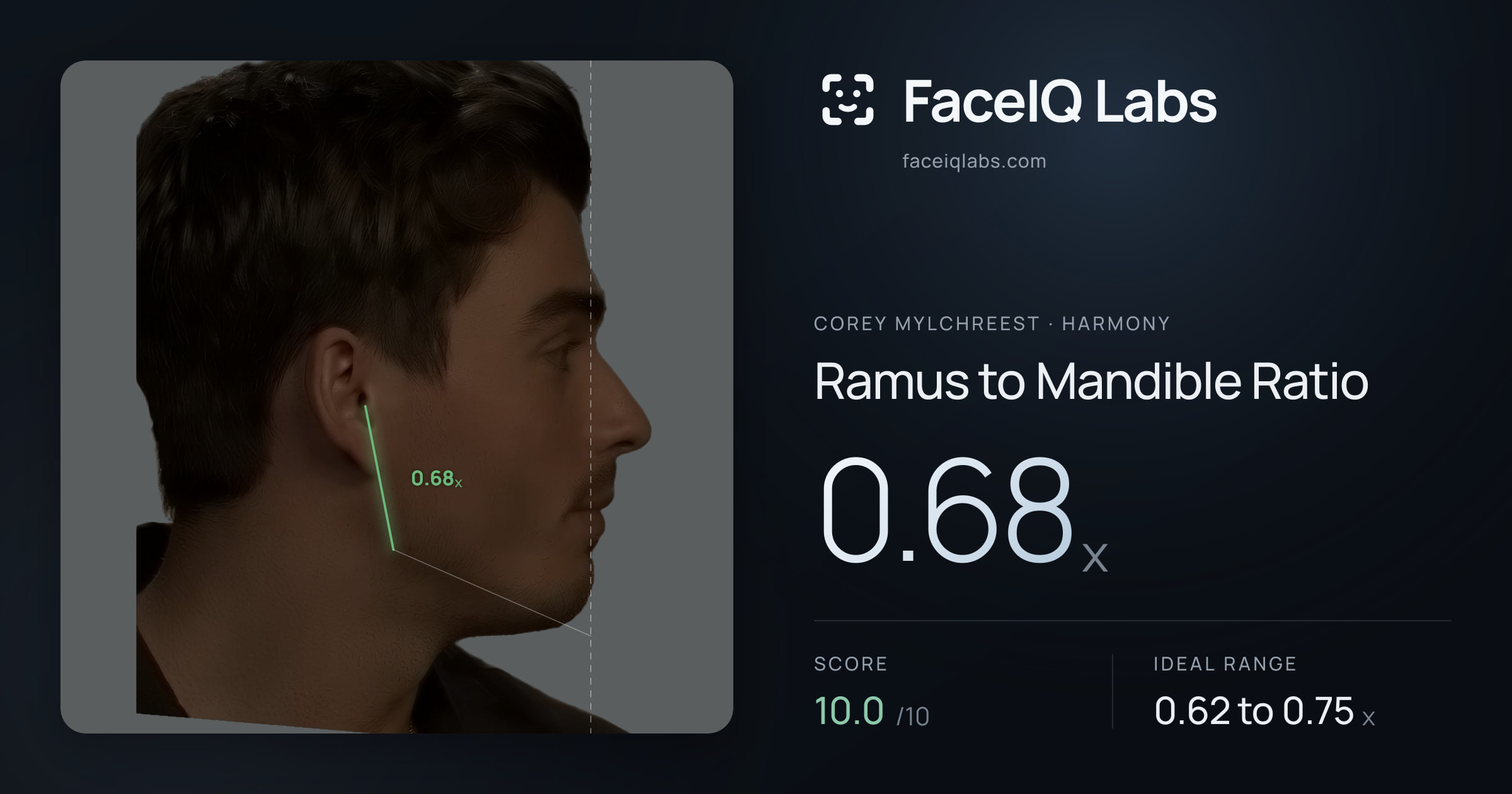 Corey Mylchreest Ramus to Mandible Ratio: 0.68x, drawn on the photo