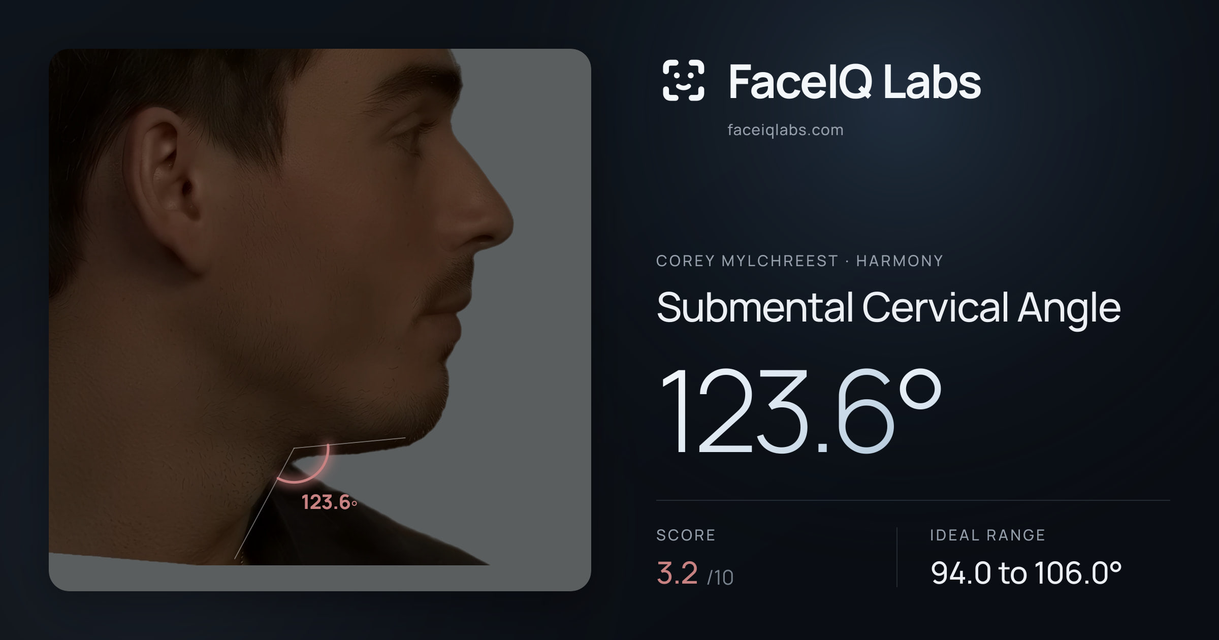 Corey Mylchreest Submental Cervical Angle: 123.6°, drawn on the photo
