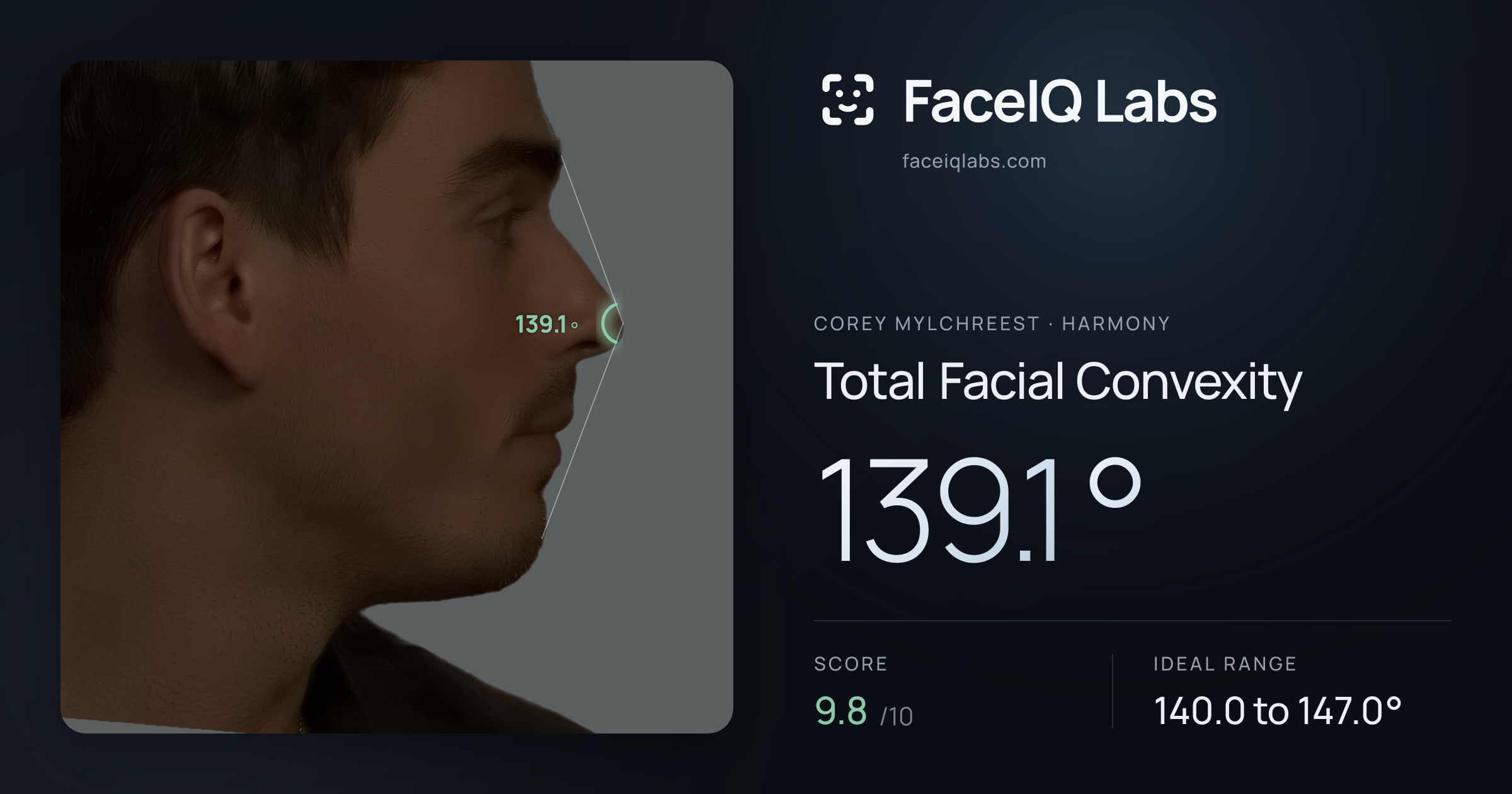 Corey Mylchreest Total Facial Convexity: 139.1°, drawn on the photo