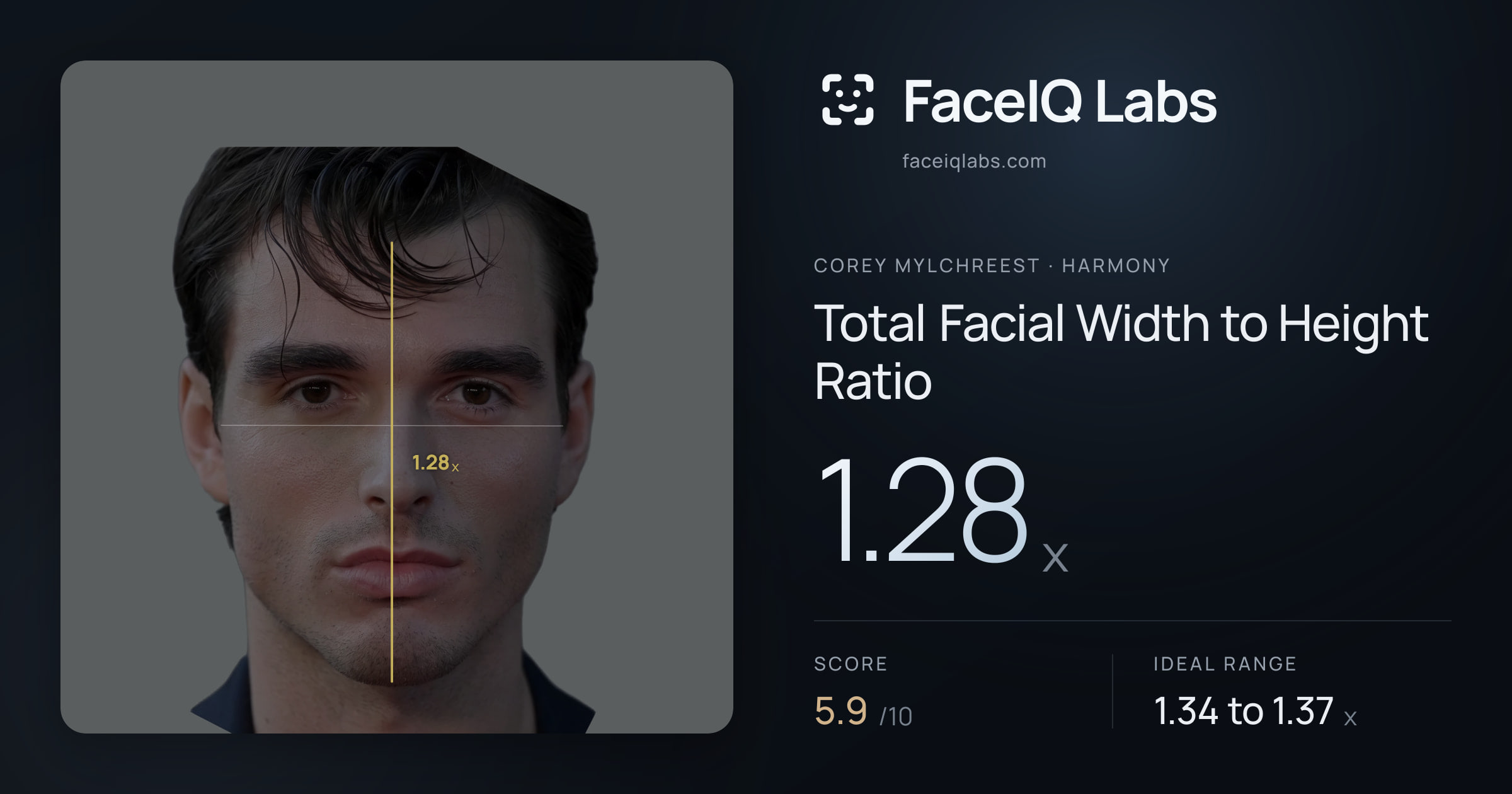 Corey Mylchreest Total Facial Width to Height Ratio: 1.28x, drawn on the photo
