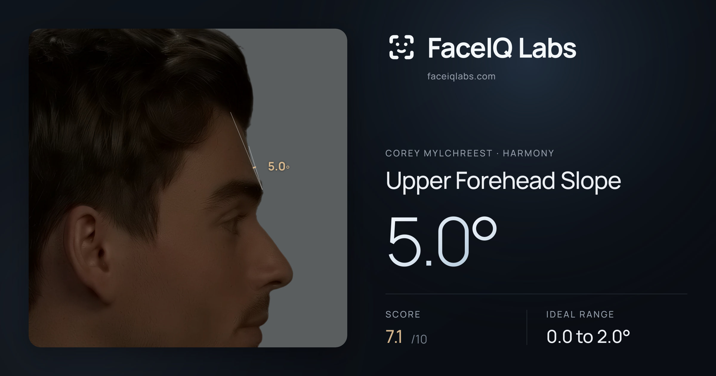 Corey Mylchreest Upper Forehead Slope: 5.0°, drawn on the photo