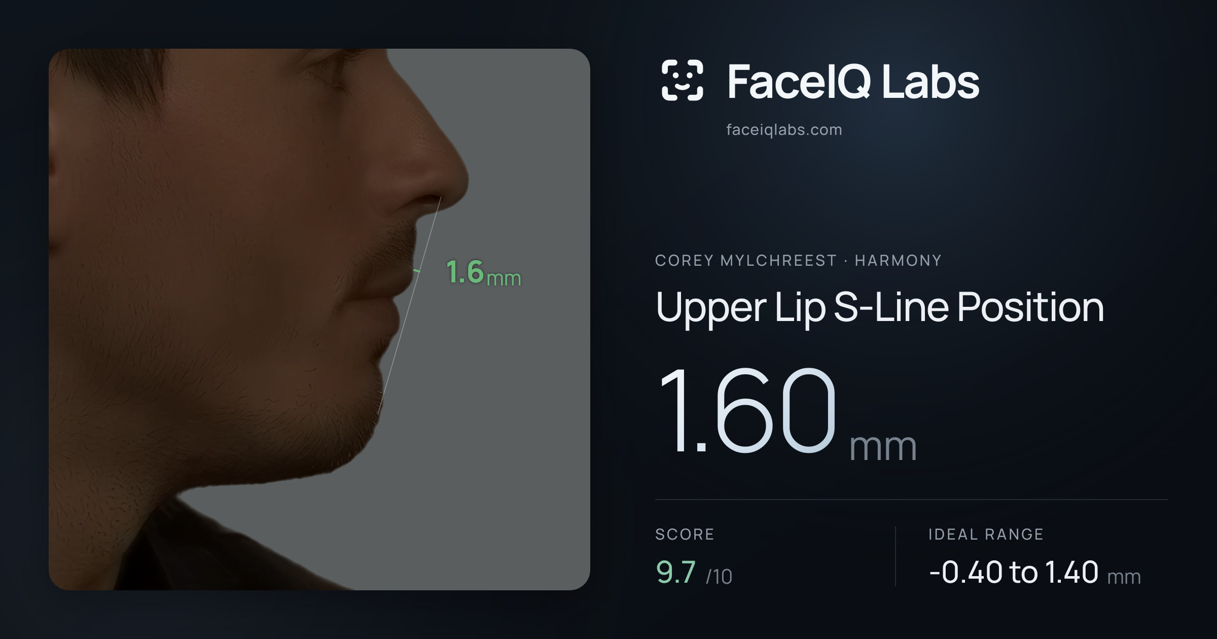 Corey Mylchreest Upper Lip S-Line Position: 1.60mm, drawn on the photo
