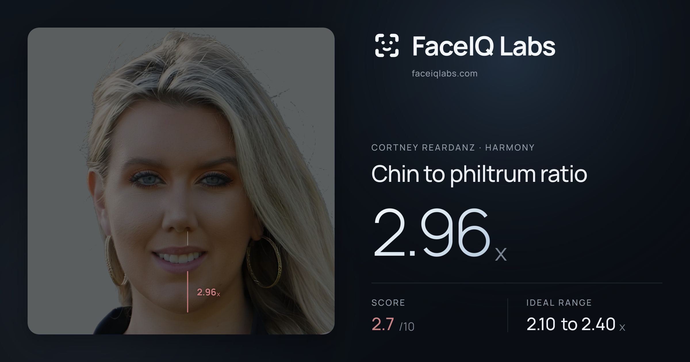 Cortney Reardanz Chin to philtrum ratio: 2.96x, drawn on the photo