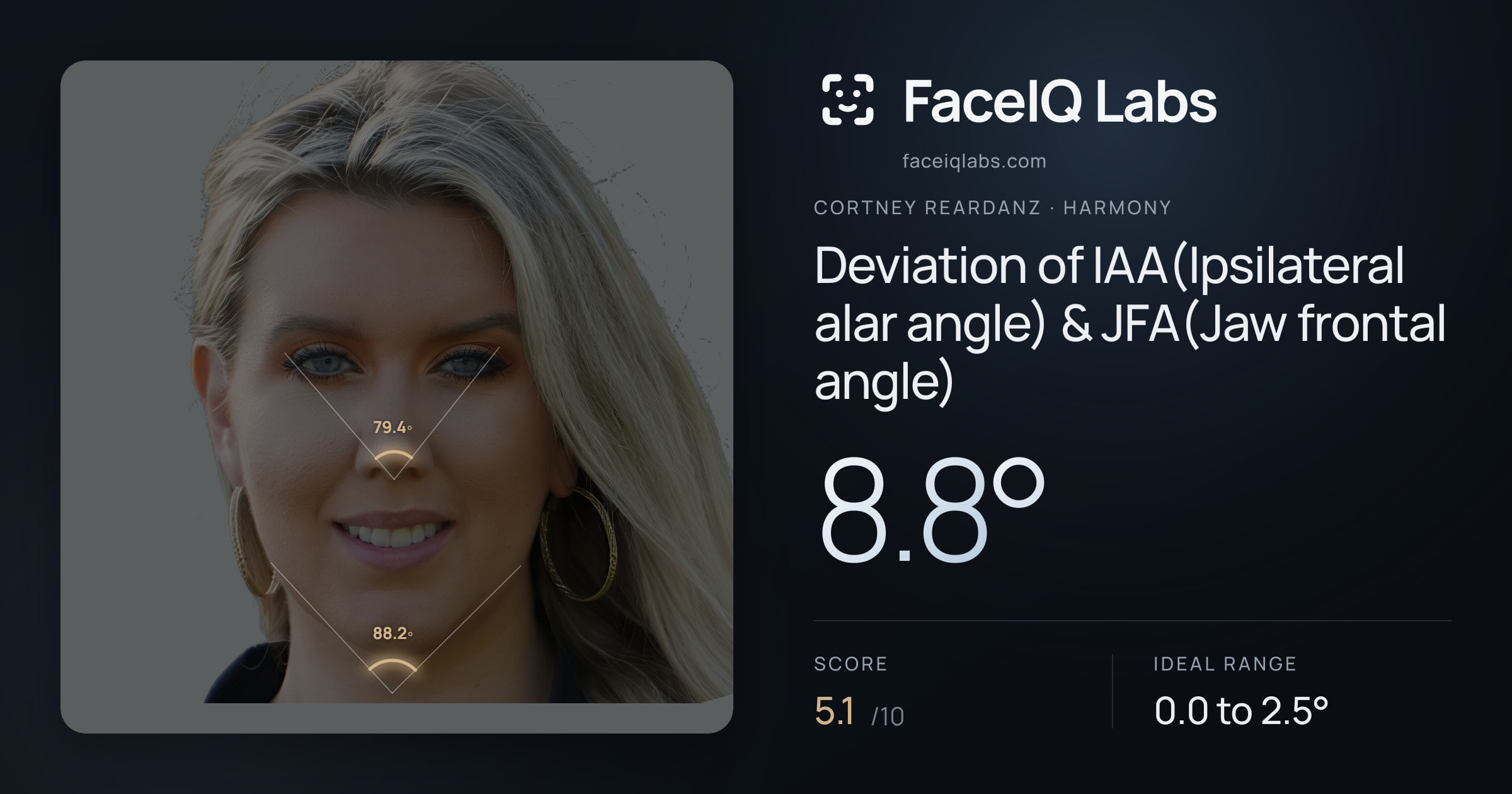 Cortney Reardanz Deviation of IAA(Ipsilateral alar angle) & JFA(Jaw frontal angle): 8.8°, drawn on the photo