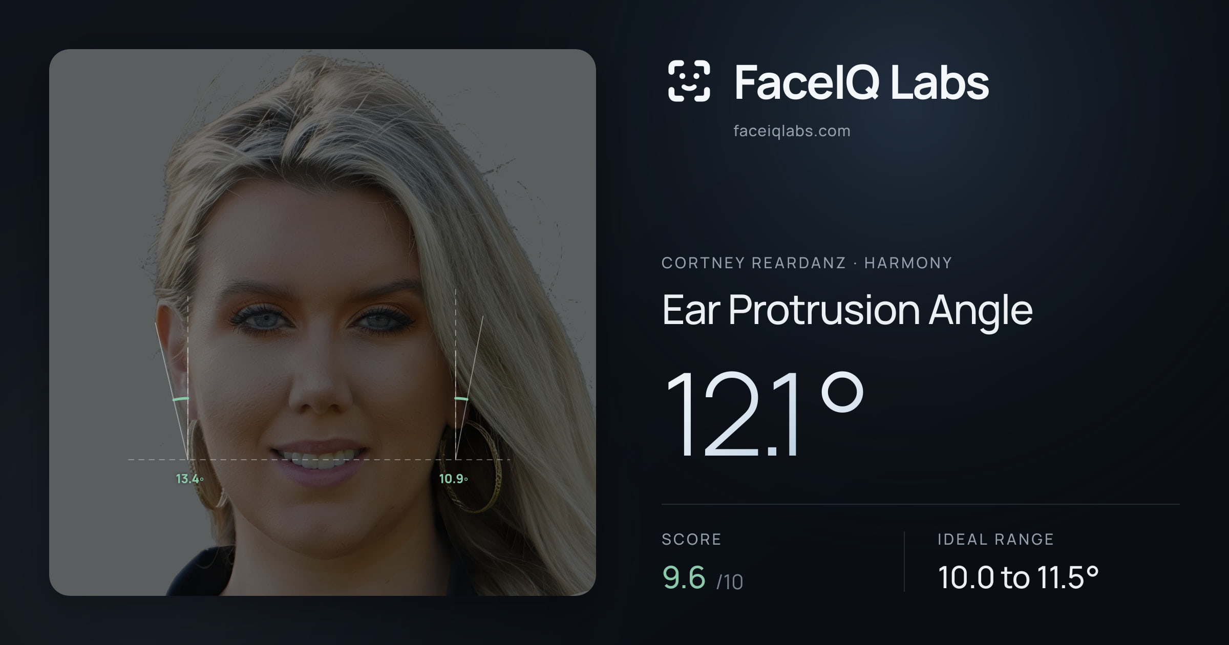 Cortney Reardanz Ear Protrusion Angle: 12.1°, drawn on the photo