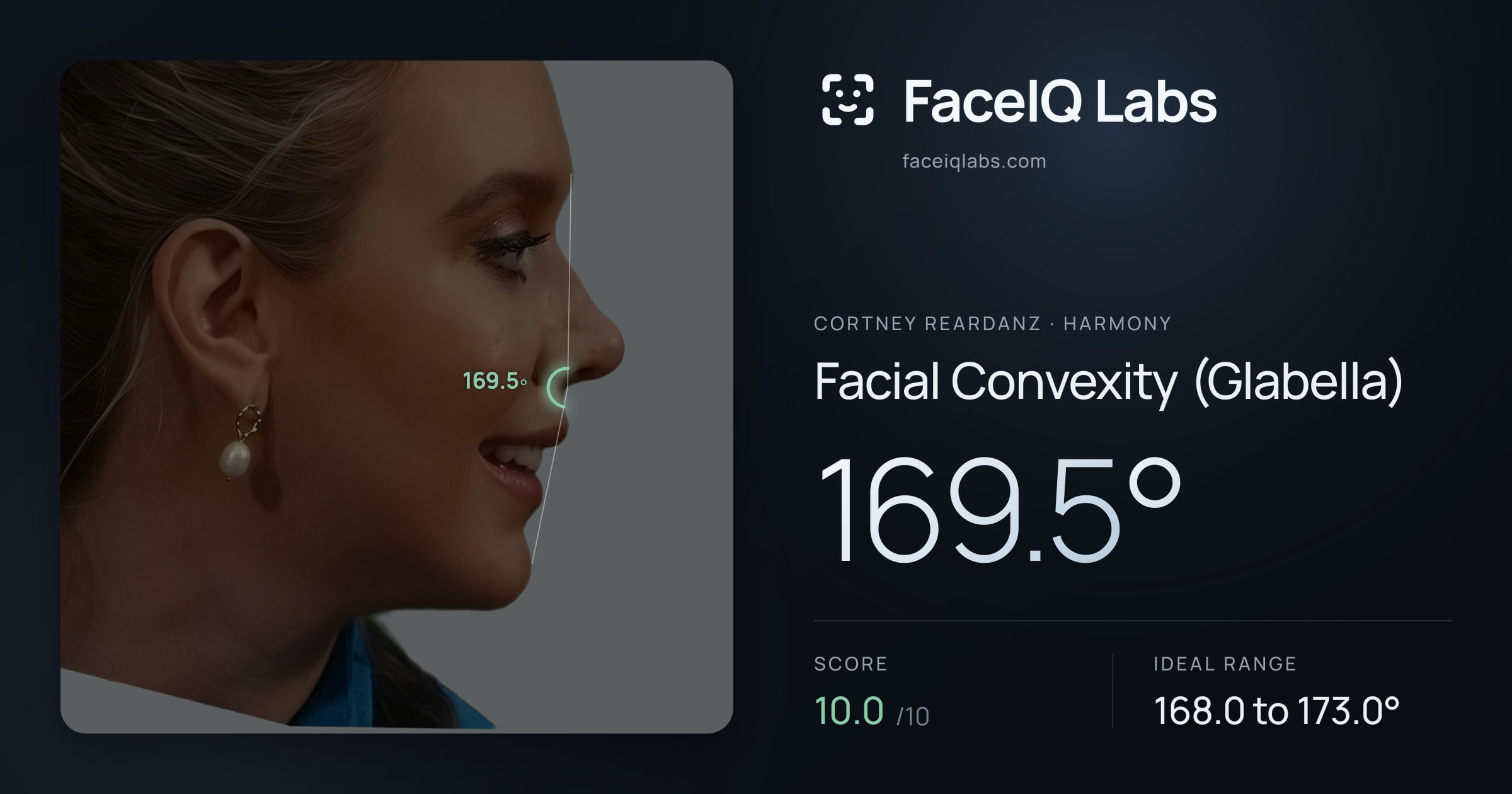Cortney Reardanz Facial Convexity (Glabella): 169.5°, drawn on the photo