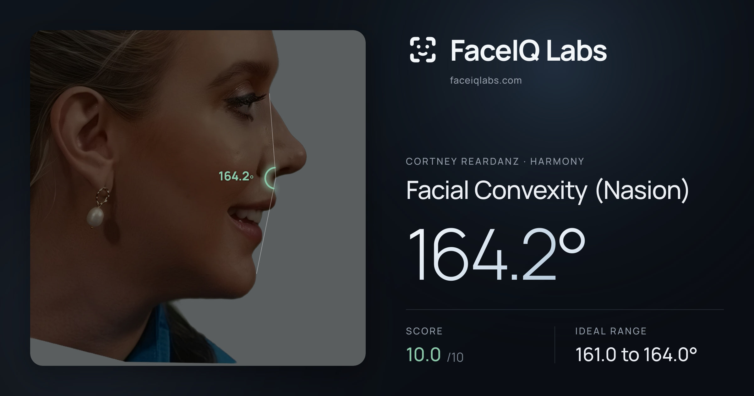 Cortney Reardanz Facial Convexity (Nasion): 164.2°, drawn on the photo