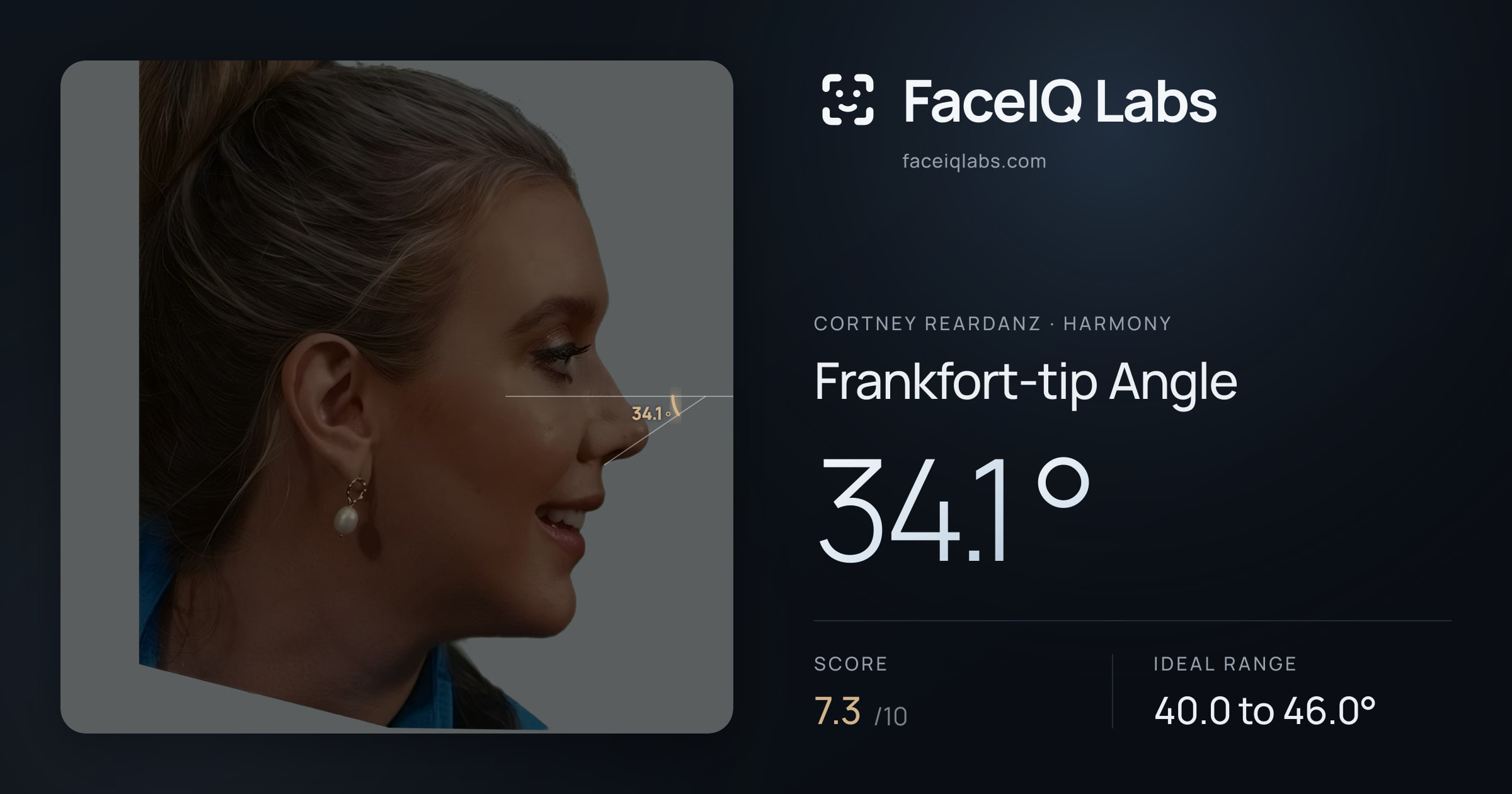 Cortney Reardanz Frankfort-tip Angle: 34.1°, drawn on the photo