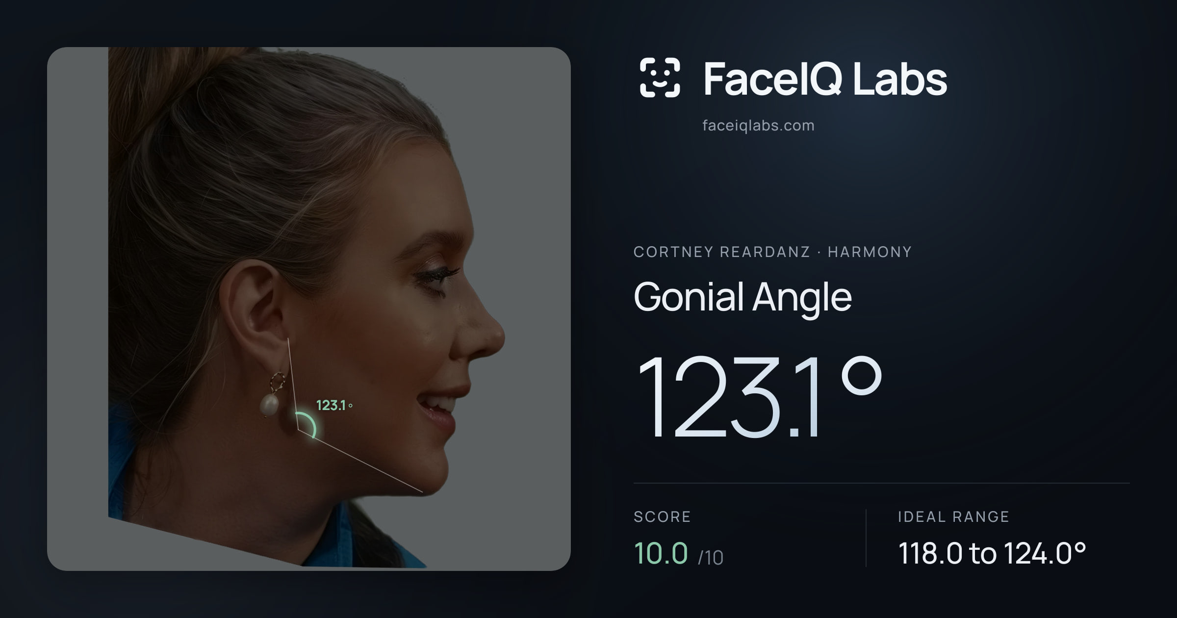 Cortney Reardanz Gonial Angle: 123.1°, drawn on the photo